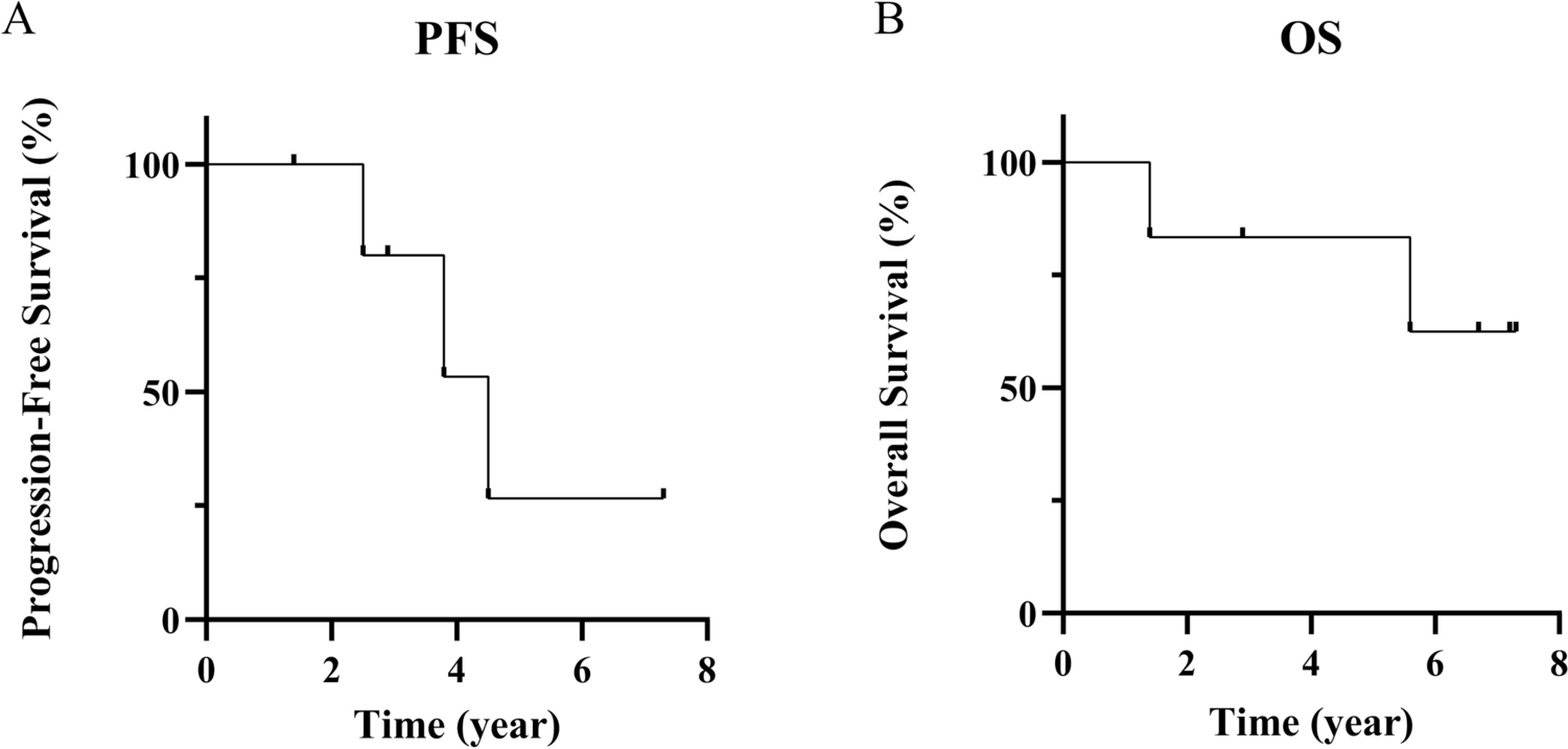 Tectal glioma: clinical, radiological, and pathological features, and the importance of molecular analysis