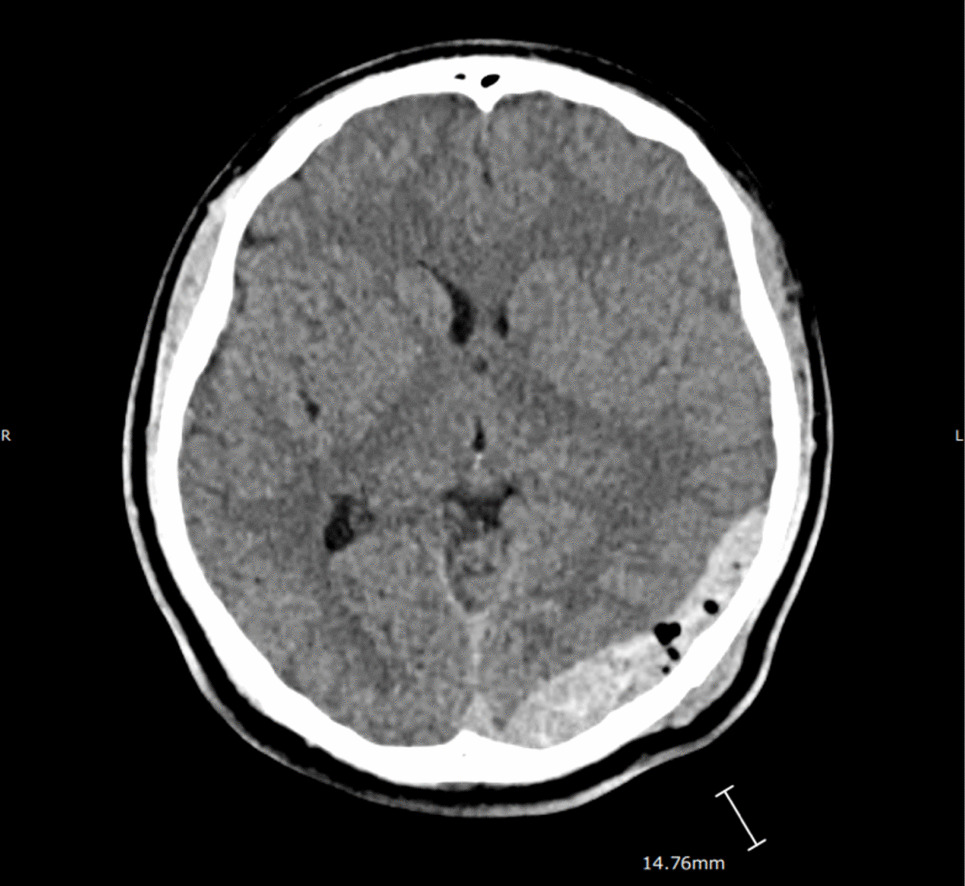 Linguistic and Cultural Diversity Considerations When Working With Families in a Pediatric Multidisciplinary Concussion Setting: A Case Study Illustration