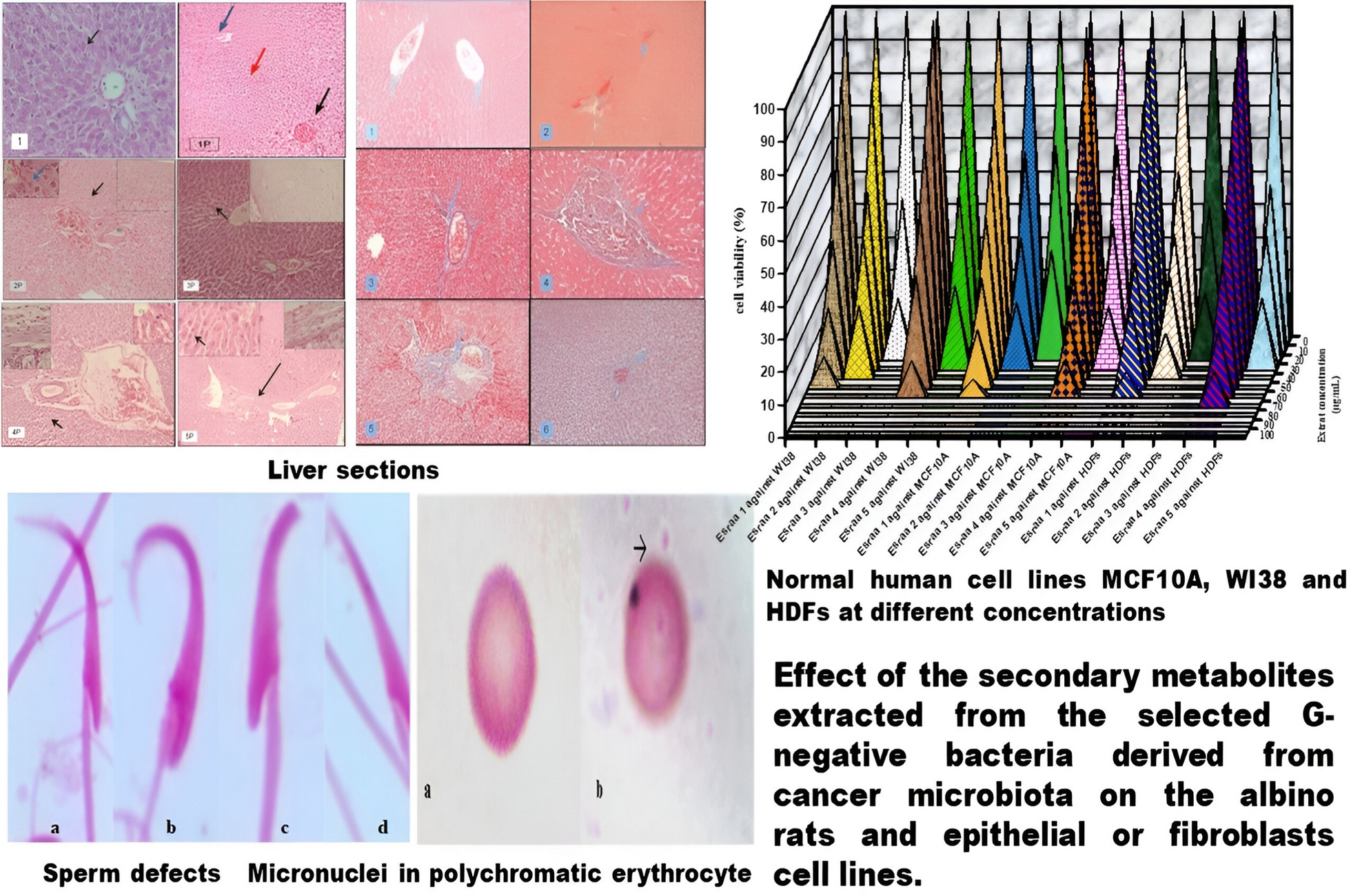 Evaluation of multidrug resistance in the Gram-negative microbiome of cancer patients and the adverse effects of their metabolites on albino rats and epithelial or fibroblasts cell lines