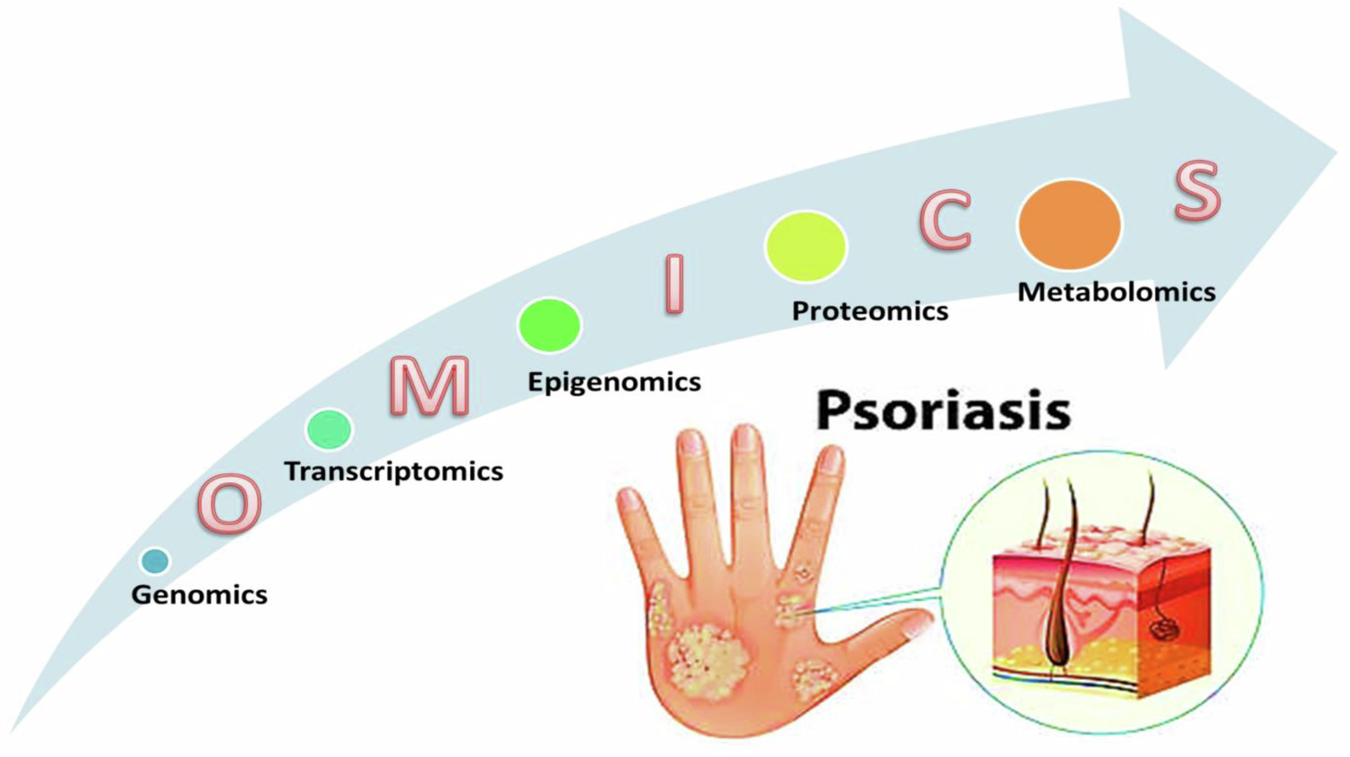 Integrating omics data for personalized medicine in treating psoriasis