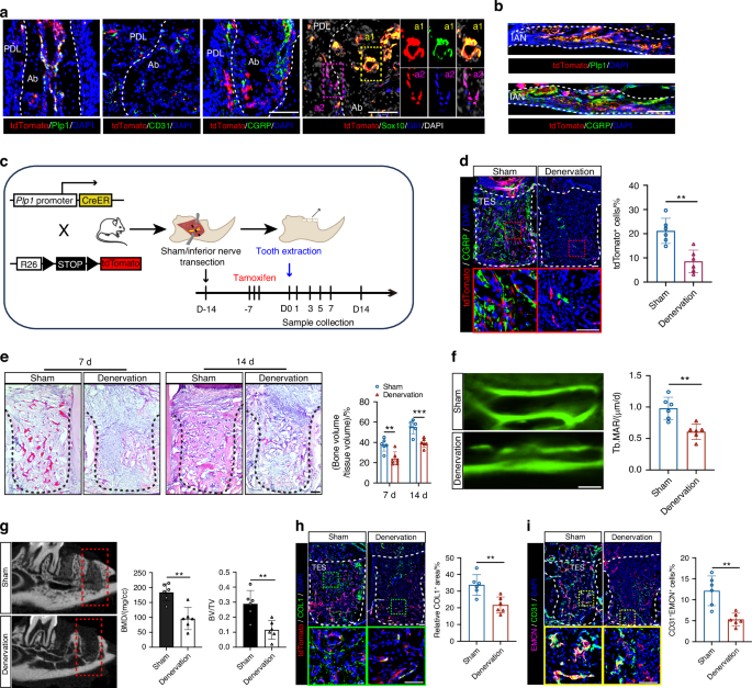 Enhancer-driven Shh signaling promotes glia-to-mesenchyme transition during bone repair