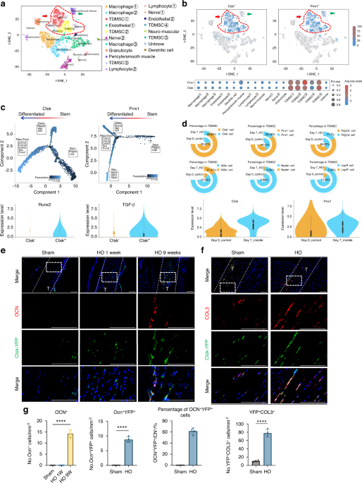 Polycystin-1 regulates tendon-derived mesenchymal stem cells fate and matrix organization in heterotopic ossification