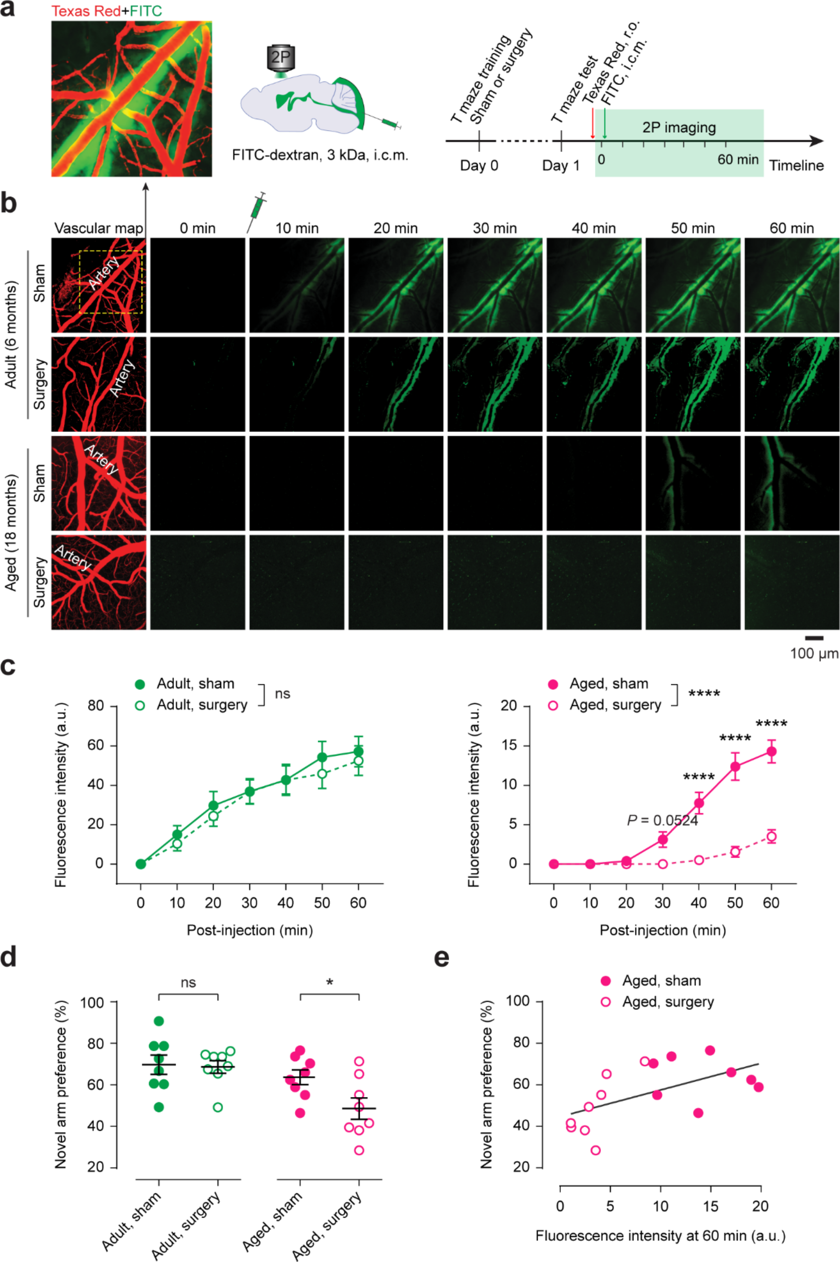 Surgery impairs glymphatic activity and cognitive function in aged mice