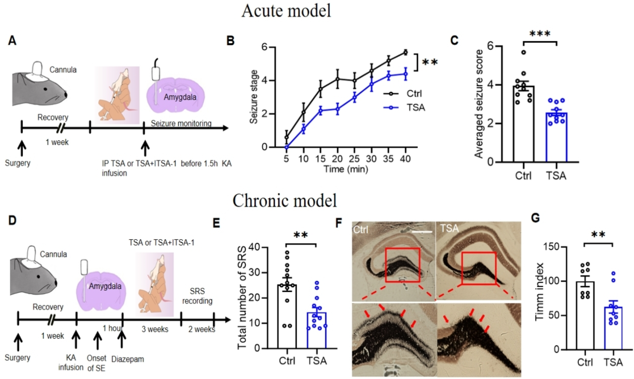 Regulation of Glutamate Transporter Type 1 by TSA and the Antiepileptic Mechanism of TSA