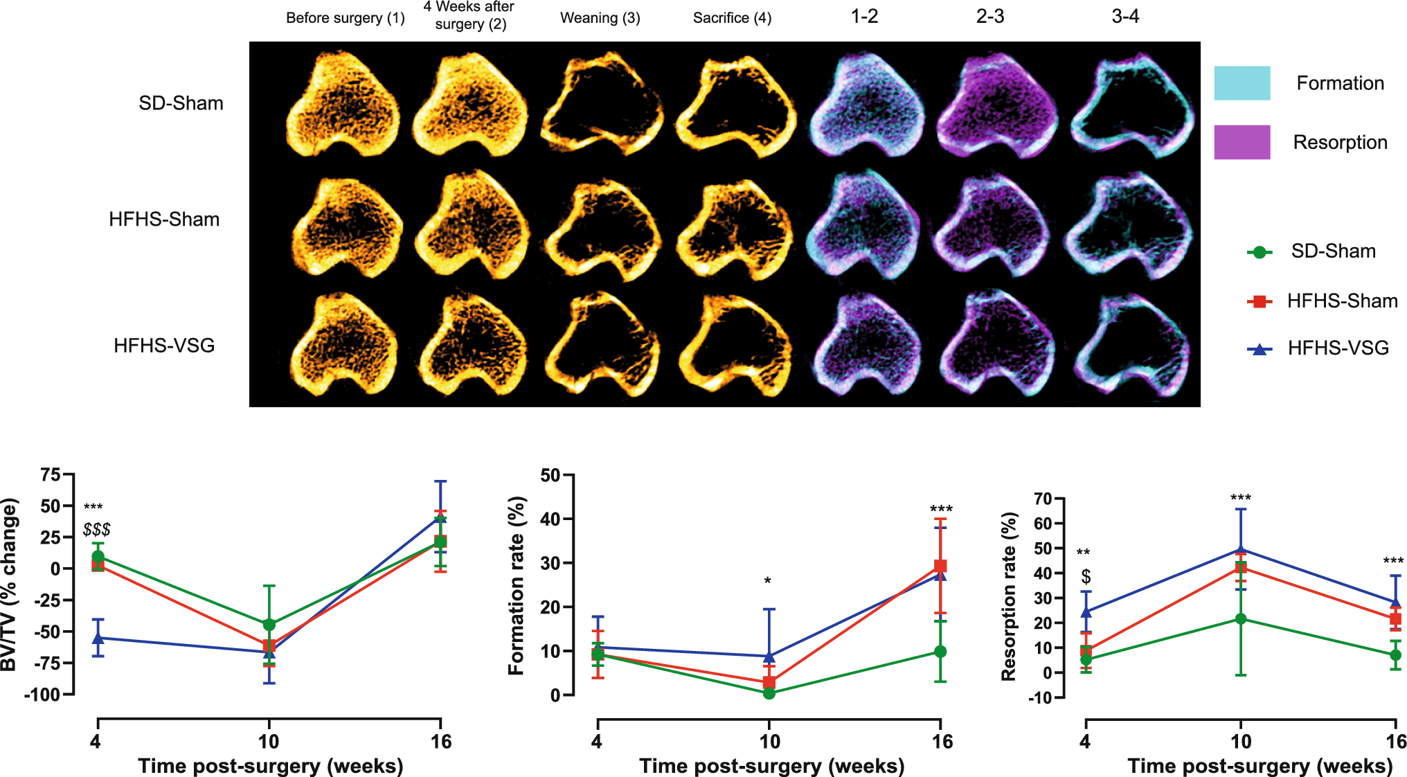 Effects of Pregnancy and Lactation on Bone Microstructure and Material Properties in a Rat Model of Bariatric Surgery