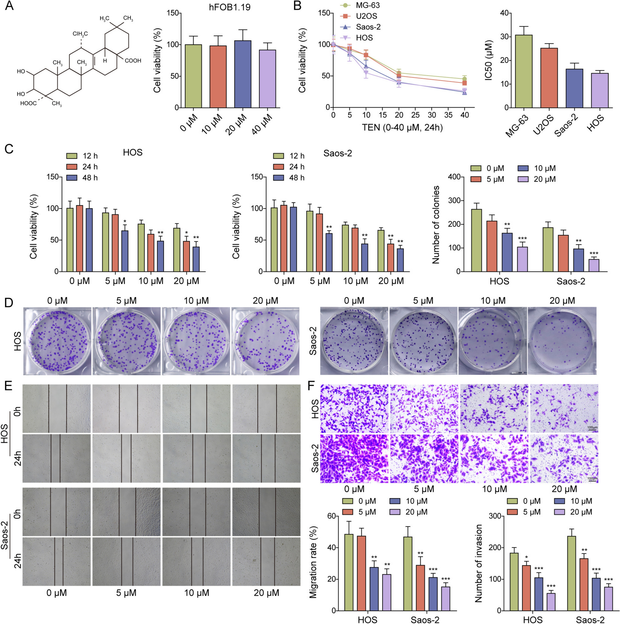 Tenuigenin inhibits osteosarcoma growth via CIP2A/PP2A/NF-κB axis