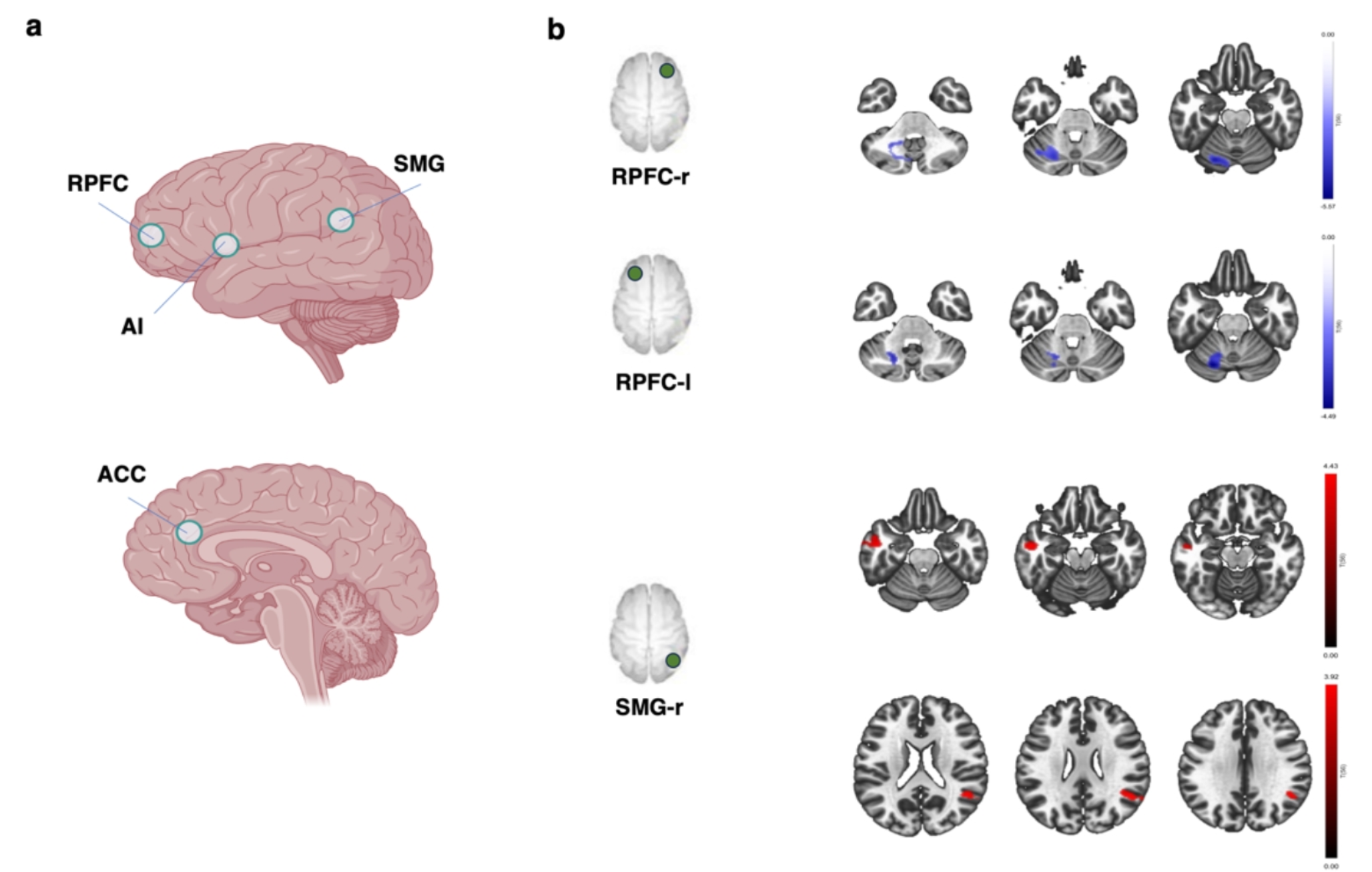 Salience Network in Autism: preliminary results on functional connectivity analysis in resting state