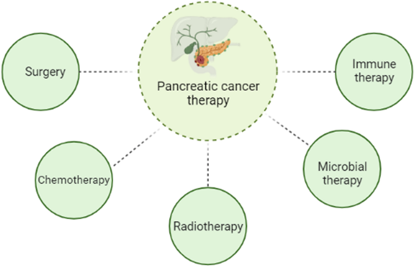 New insights into Notch signaling as a crucial pathway of pancreatic cancer stem cell behavior by chrysin-polylactic acid-based nanocomposite