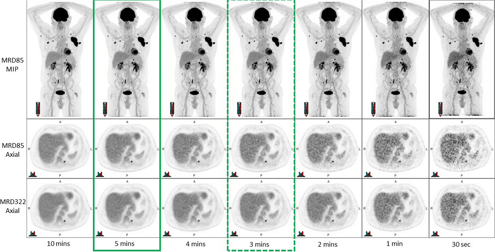 Optimisation of low and ultra-low dose scanning protocols for ultra-extended field of view PET in a real-world clinical setting