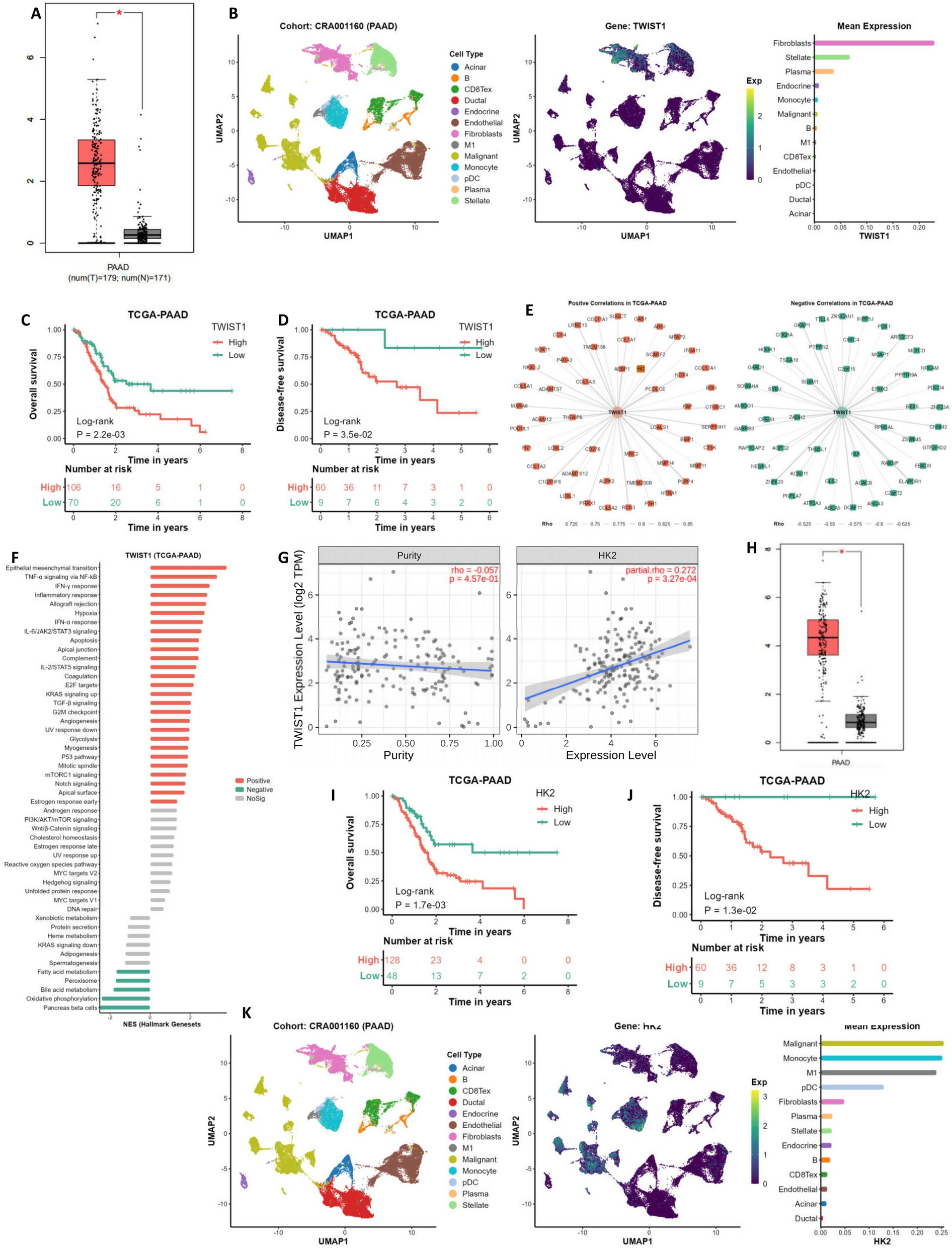 TWIST1 regulates HK2 ubiquitination degradation to promote pancreatic cancer invasion and metastasis