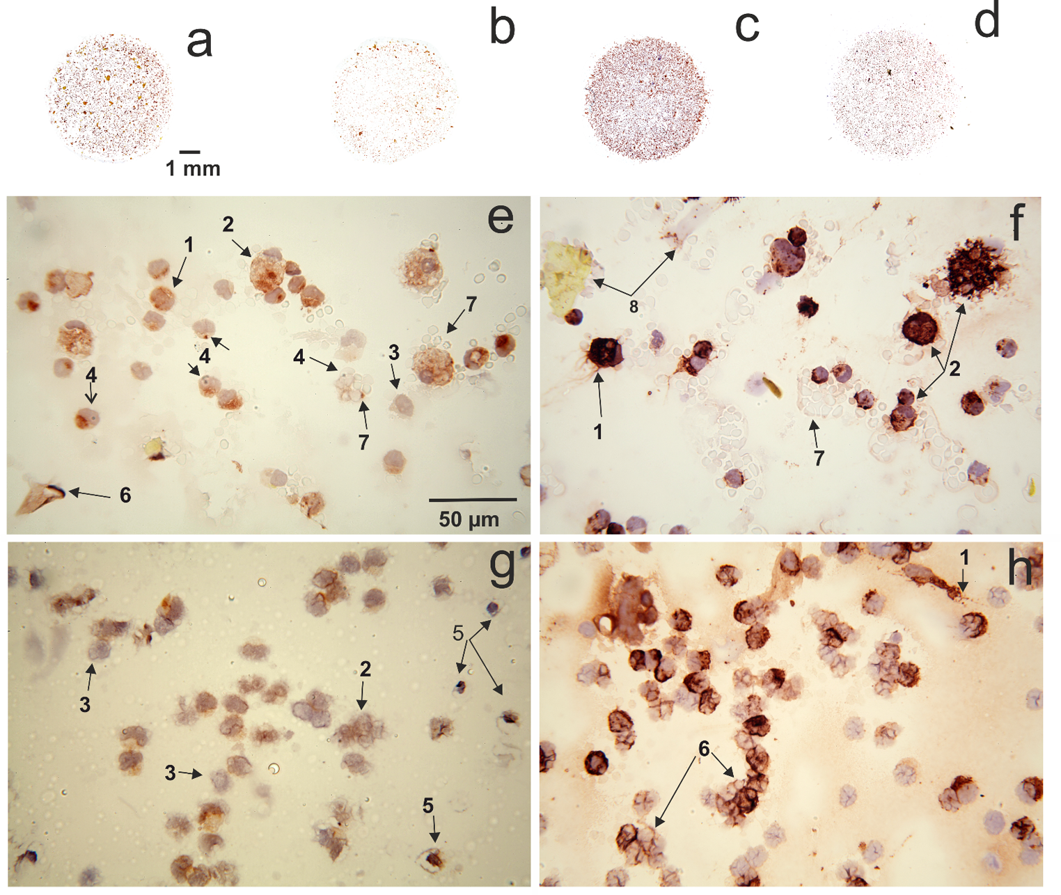 TMEM119-positive microglial cells in cerebrospinal fluid, a potential new marker for neuroinflammatory response after aneurysmal subarachnoid hemorrhage