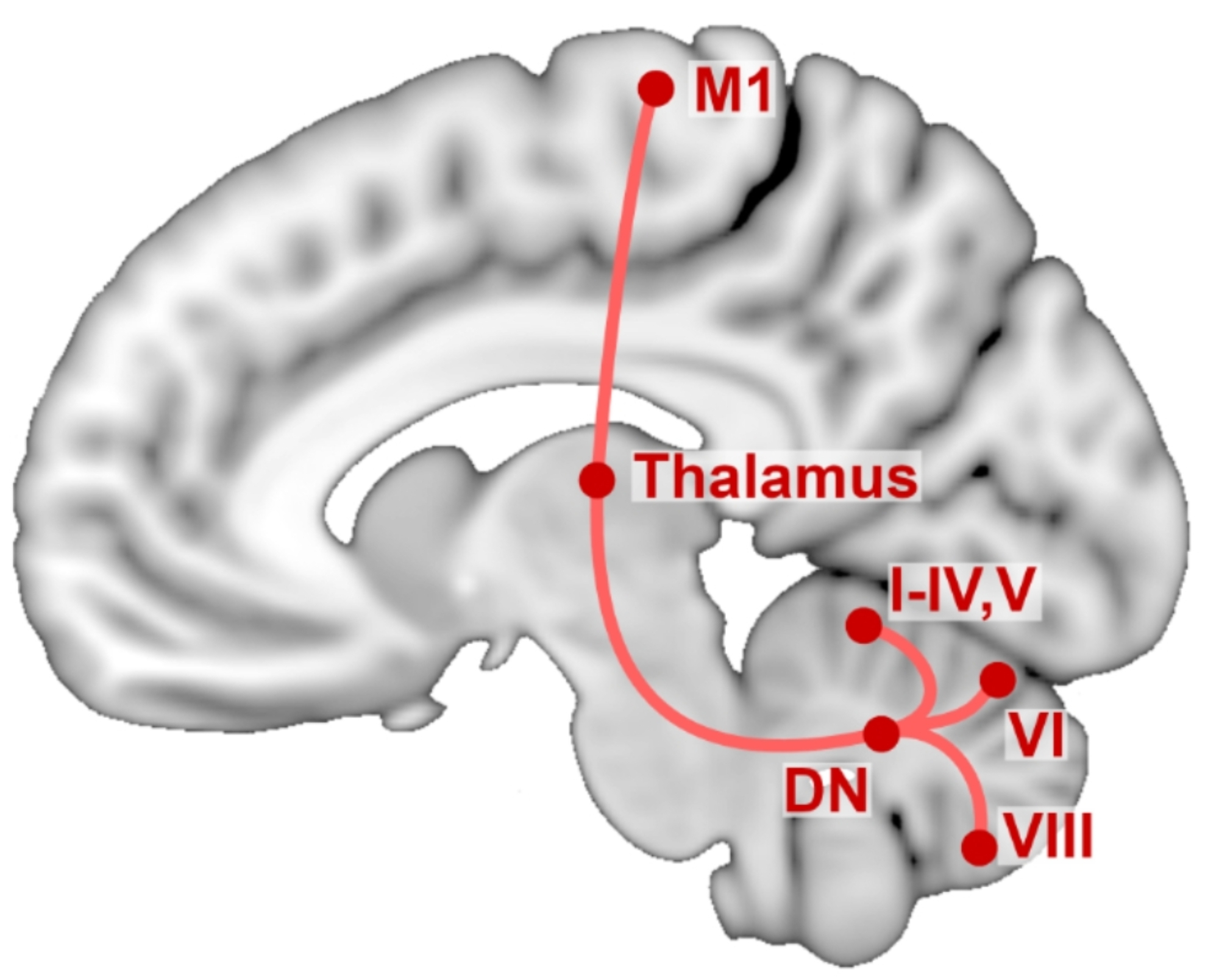 Atrophy of cerebellar lobule VI and primary motor cortex in cervical dystonia - a region of interest-based study