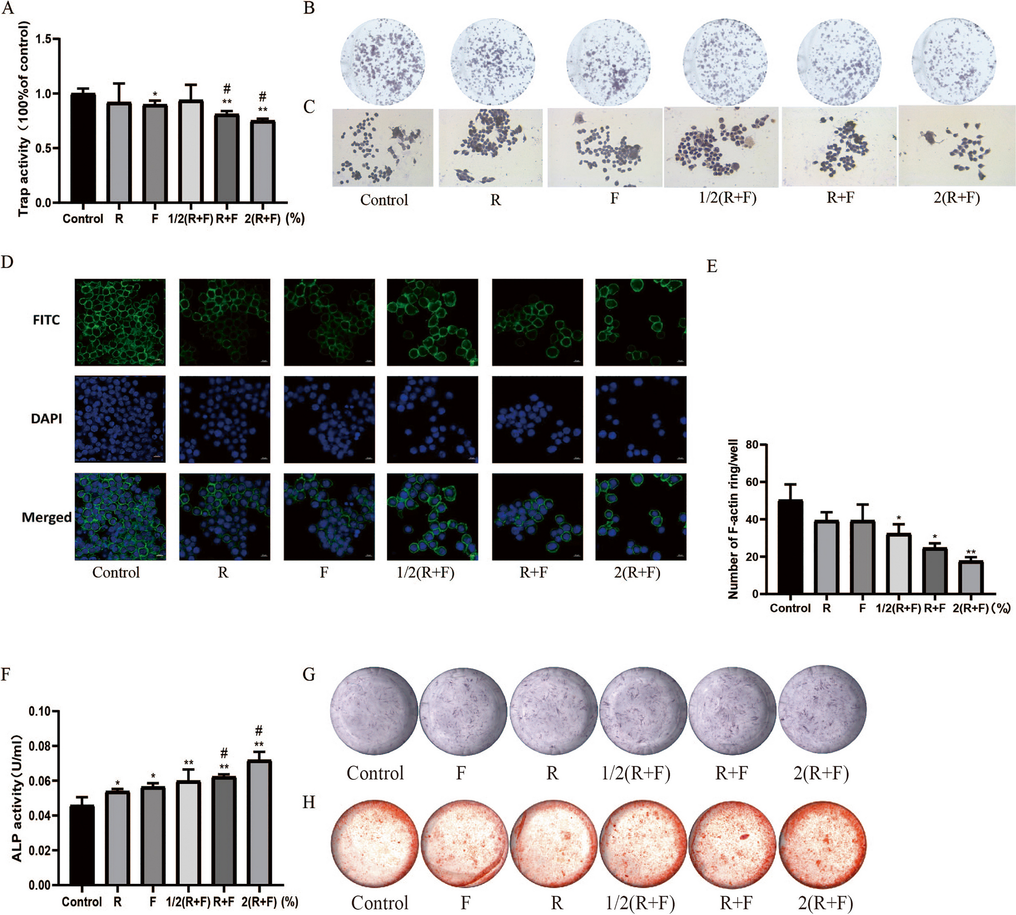 Correction: Effect of Cinnamon and Aconite on Bone Formation-Bone Absorption Coupling in Bone Microenvironment