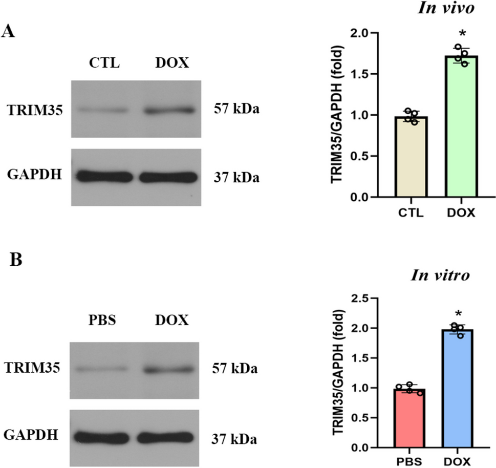 Downregulated TRIM35 Alleviates Doxorubicin-Induced Cardiotoxicity by Suppressing Oxidative Stress and Inflammation via Inhibiting TLR4/NF-κB Pathway