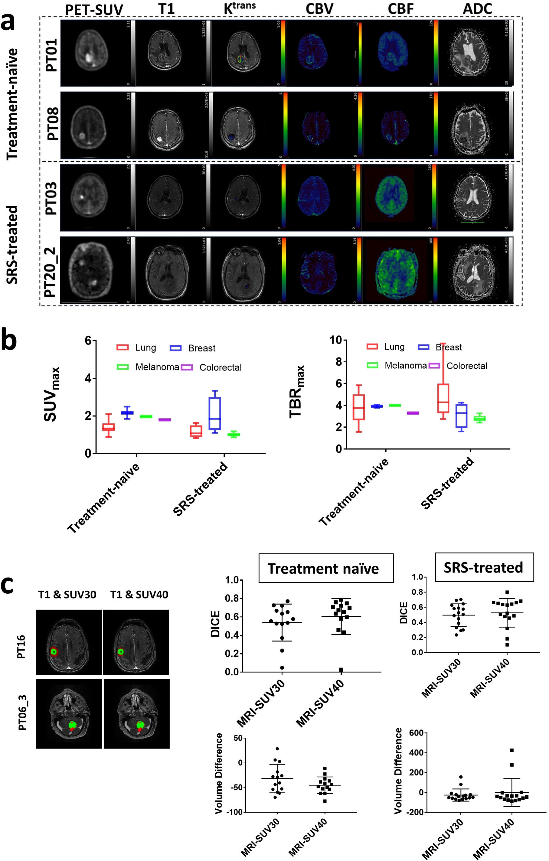 A hybrid [18F]fluoropivalate PET-multiparametric MRI to detect and characterise brain tumour metastases based on a permissive environment for monocarboxylate transport
