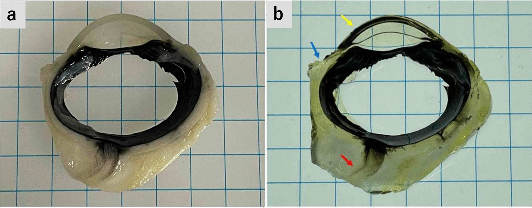 Visualization of porcine and human aqueous humor outflow tract anatomies with transparency enhancement