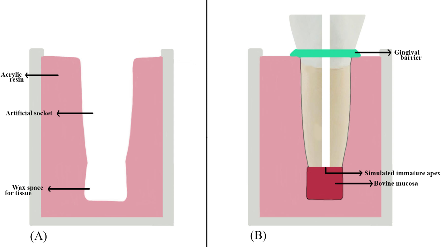 Do fiber tips with different geometric designs affect organic tissue loss in laser-activated irrigation of teeth with immature apex? An in vitro study