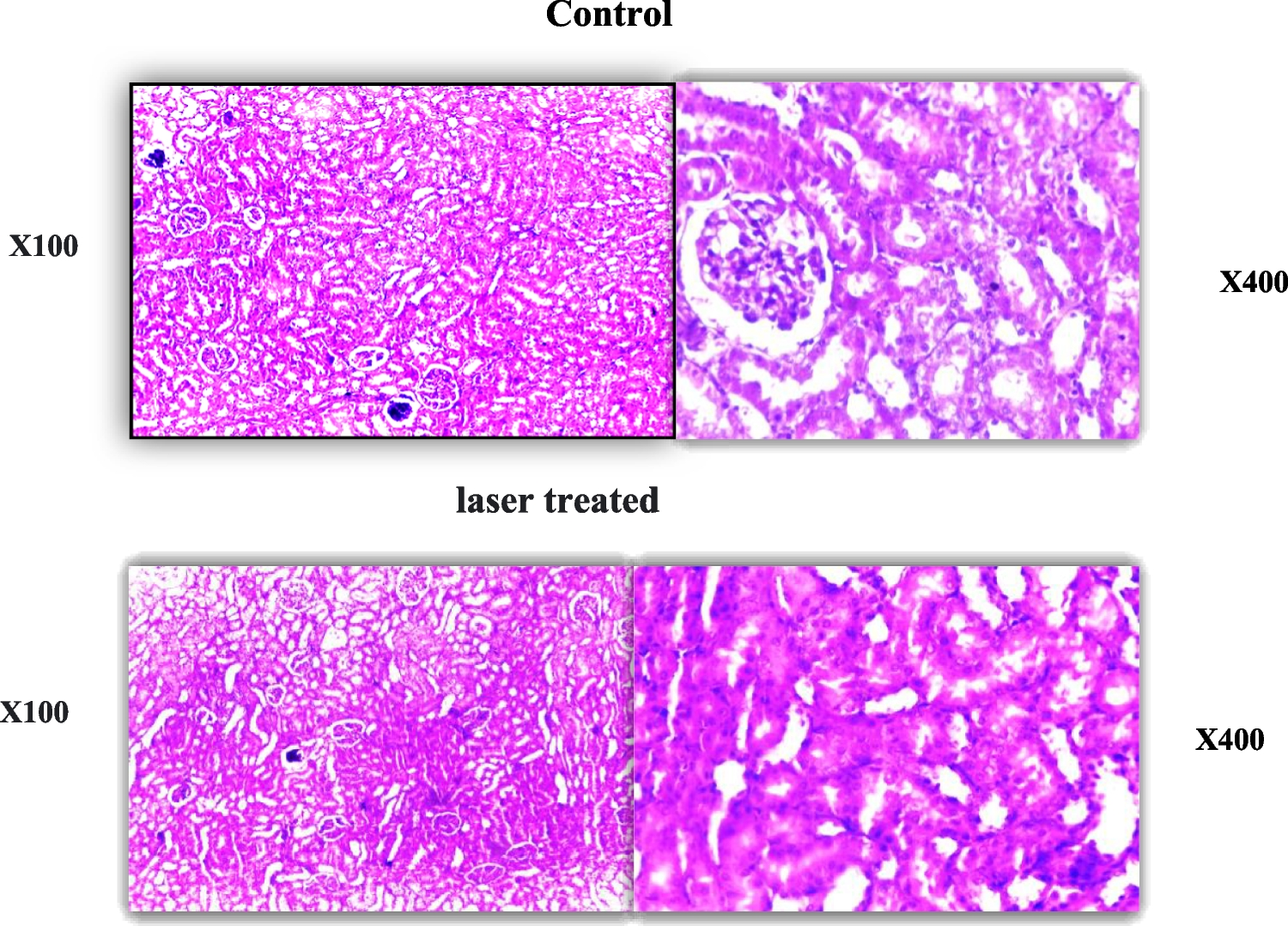 Histological effects of exposure to home hair removal laser radiation in kidney and liver of Swiss albino rats