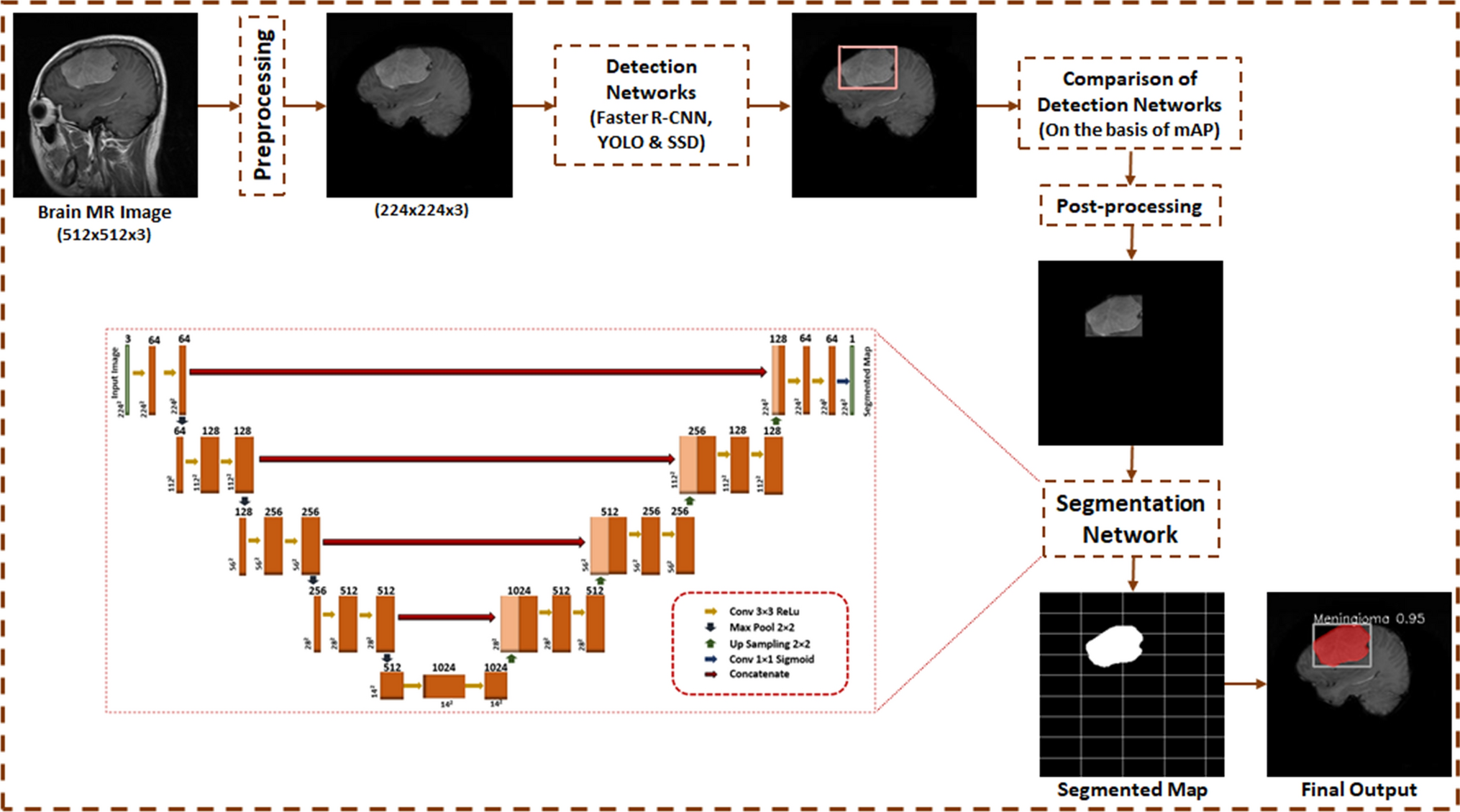 Brain tumor detection and segmentation using deep learning