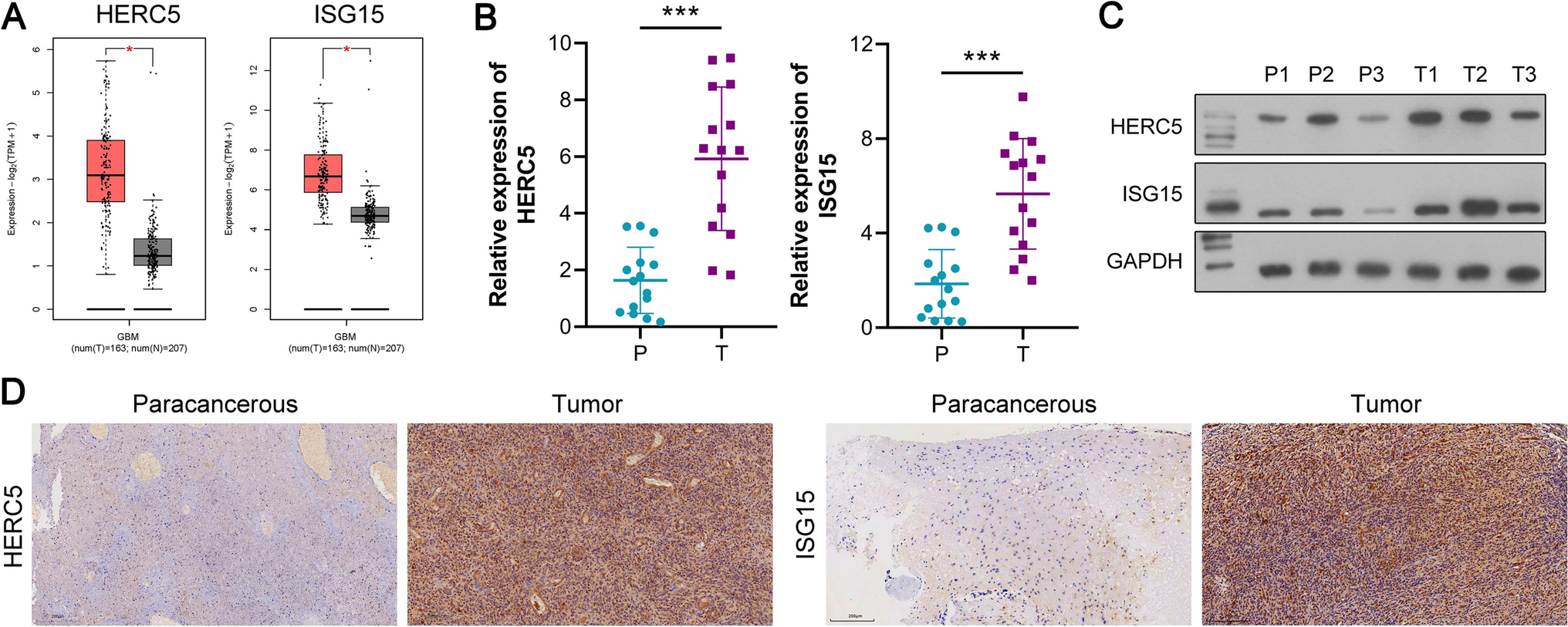 HERC5/ISG15 Enhances Glioblastoma Stemness and Tumor Progression by mediating SERBP1protein stability