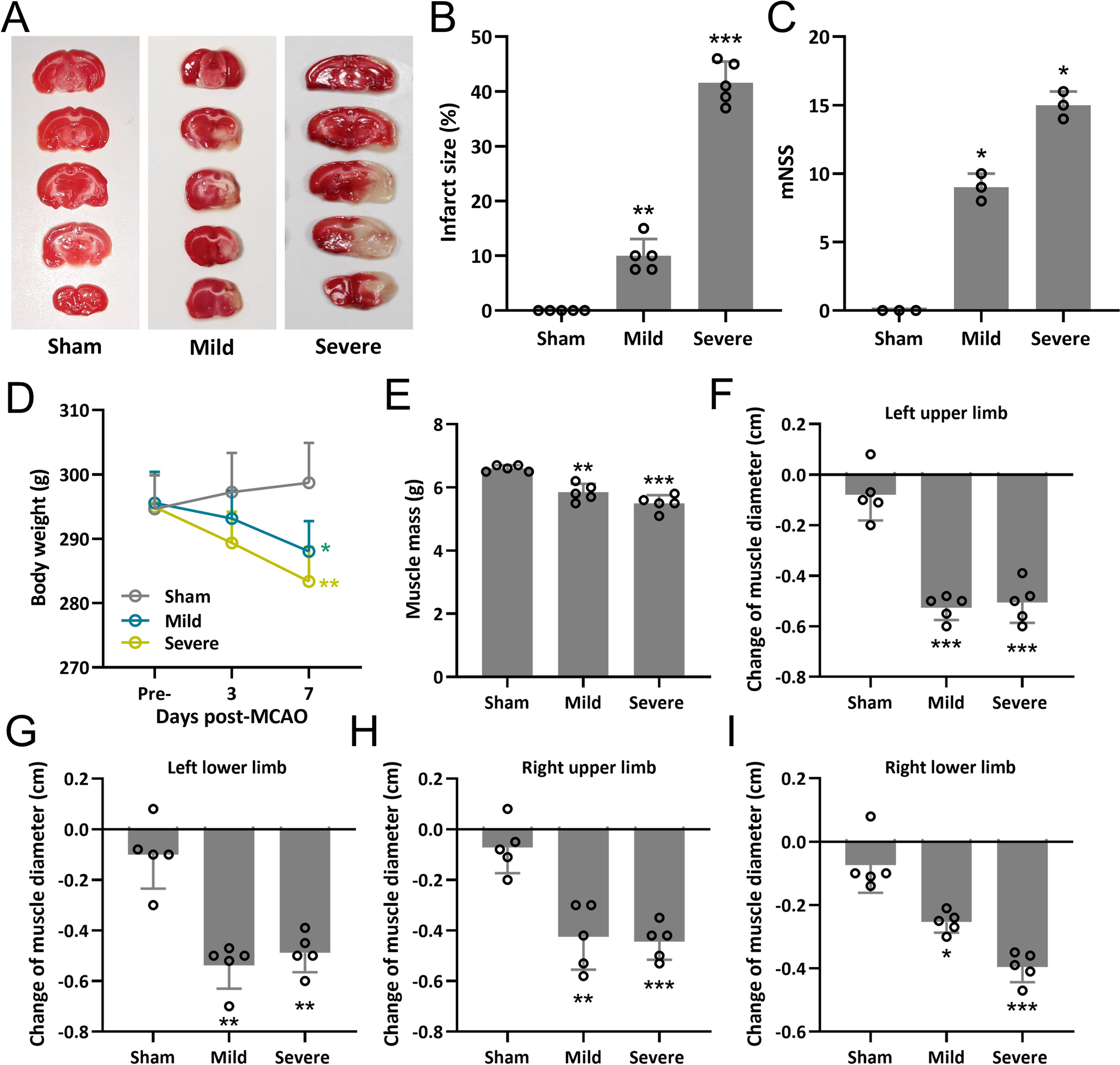 IL-6 Promotes Muscle Atrophy by Increasing Ubiquitin–Proteasome Degradation of Muscle Regeneration Factors After Cerebral Infarction in Rats
