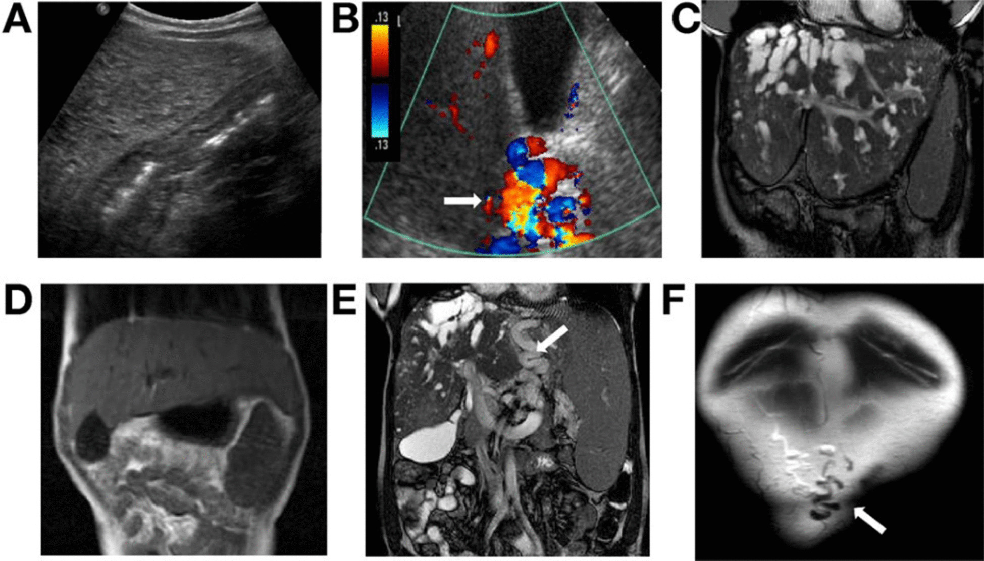 Diseases of the primary cilia: a clinical characteristics review