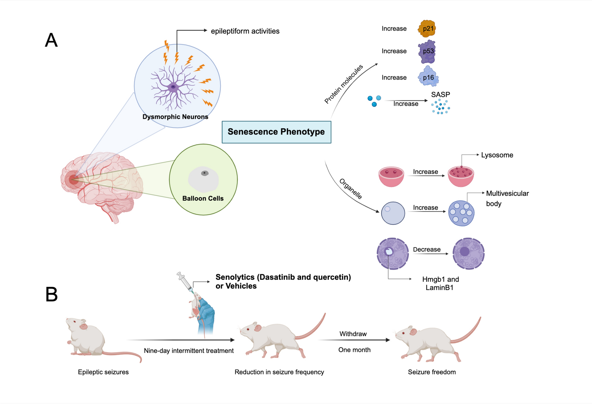 Cortical Dysplasia Beyond mTOR: Cellular Senescence Takes a Toll