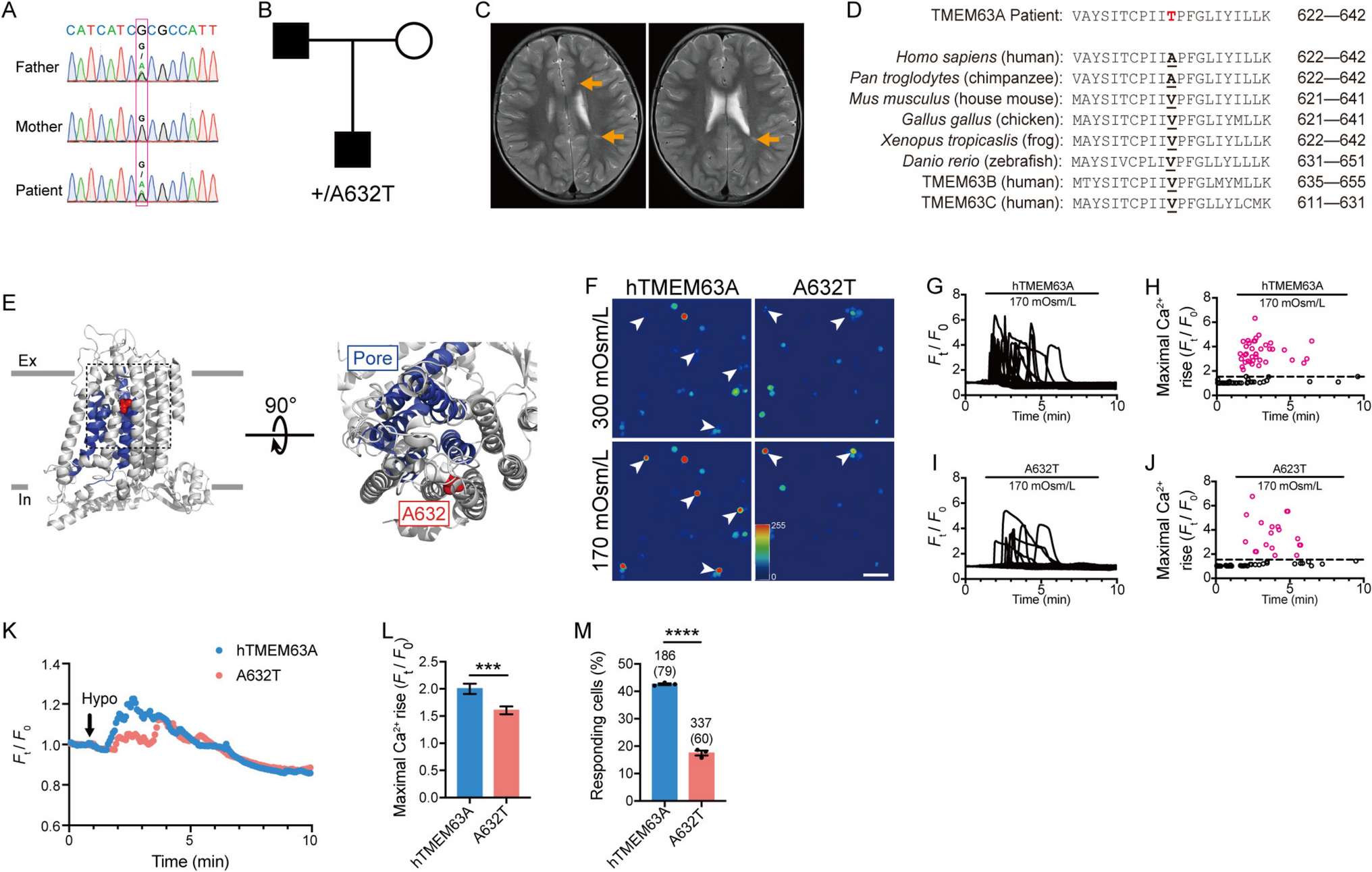 Cation Channel TMEM63A Autonomously Facilitates Oligodendrocyte Differentiation at an Early Stage
