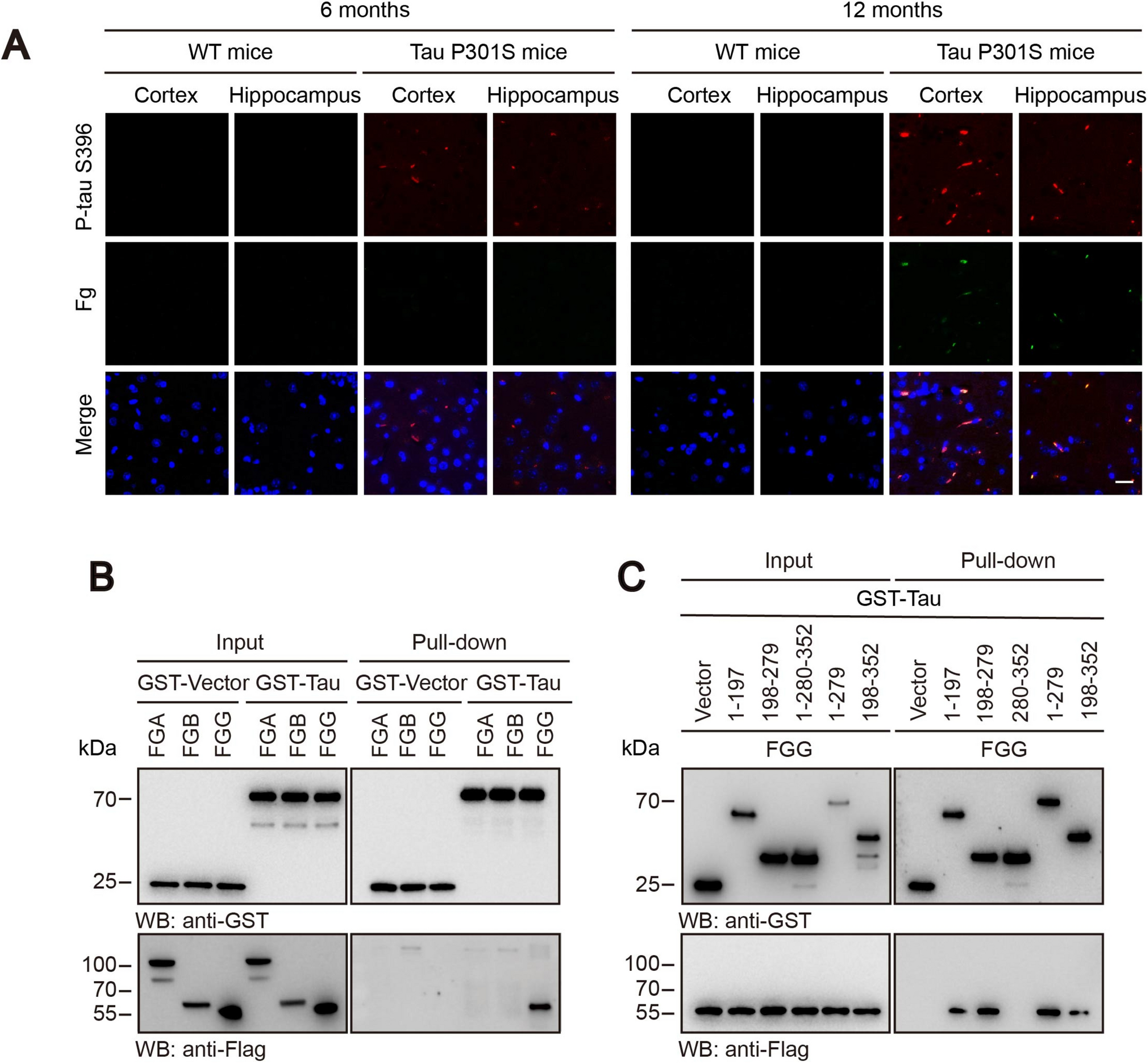 Fibrinogen-tau Aggregates Exacerbate Tau Pathology and Memory Deficits in Alzheimer’s Disease Model Mice