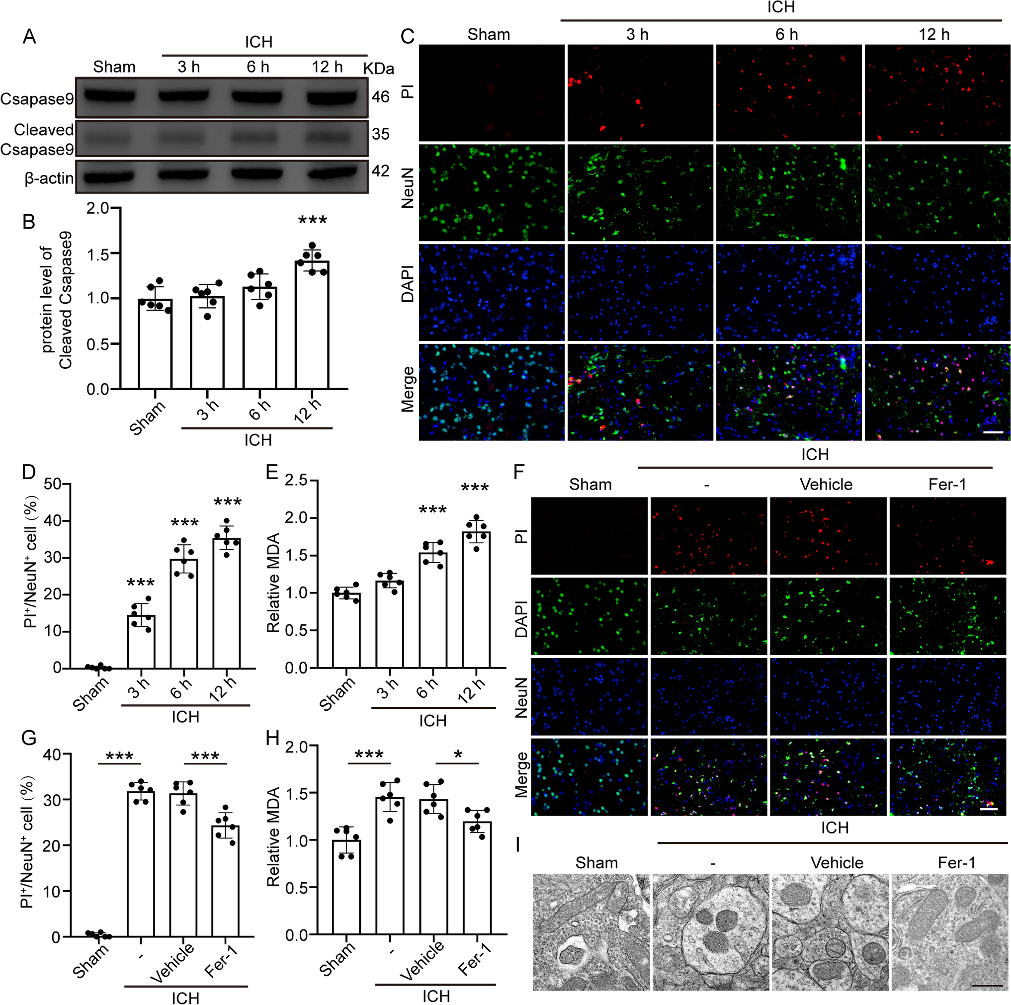 Fto-dependent Vdac3 m6A Modification Regulates Neuronal Ferroptosis Induced by the Post-ICH Mass Effect and Transferrin