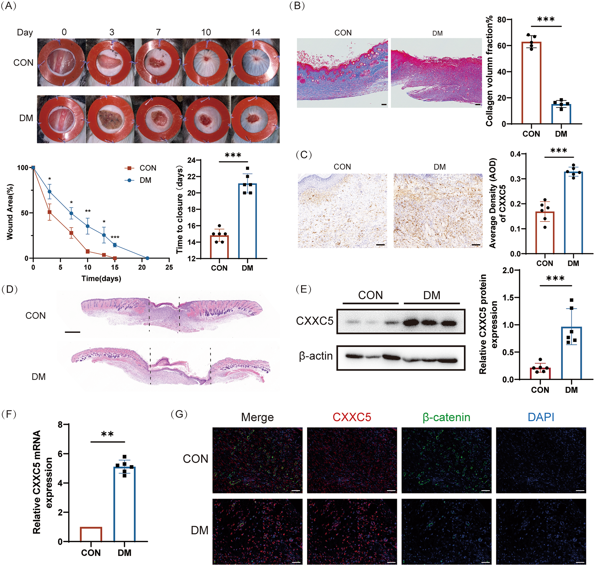 CXXC5 function blockade promotes diabetic wound healing through stimulating fibroblast and vascular endothelial cell activation