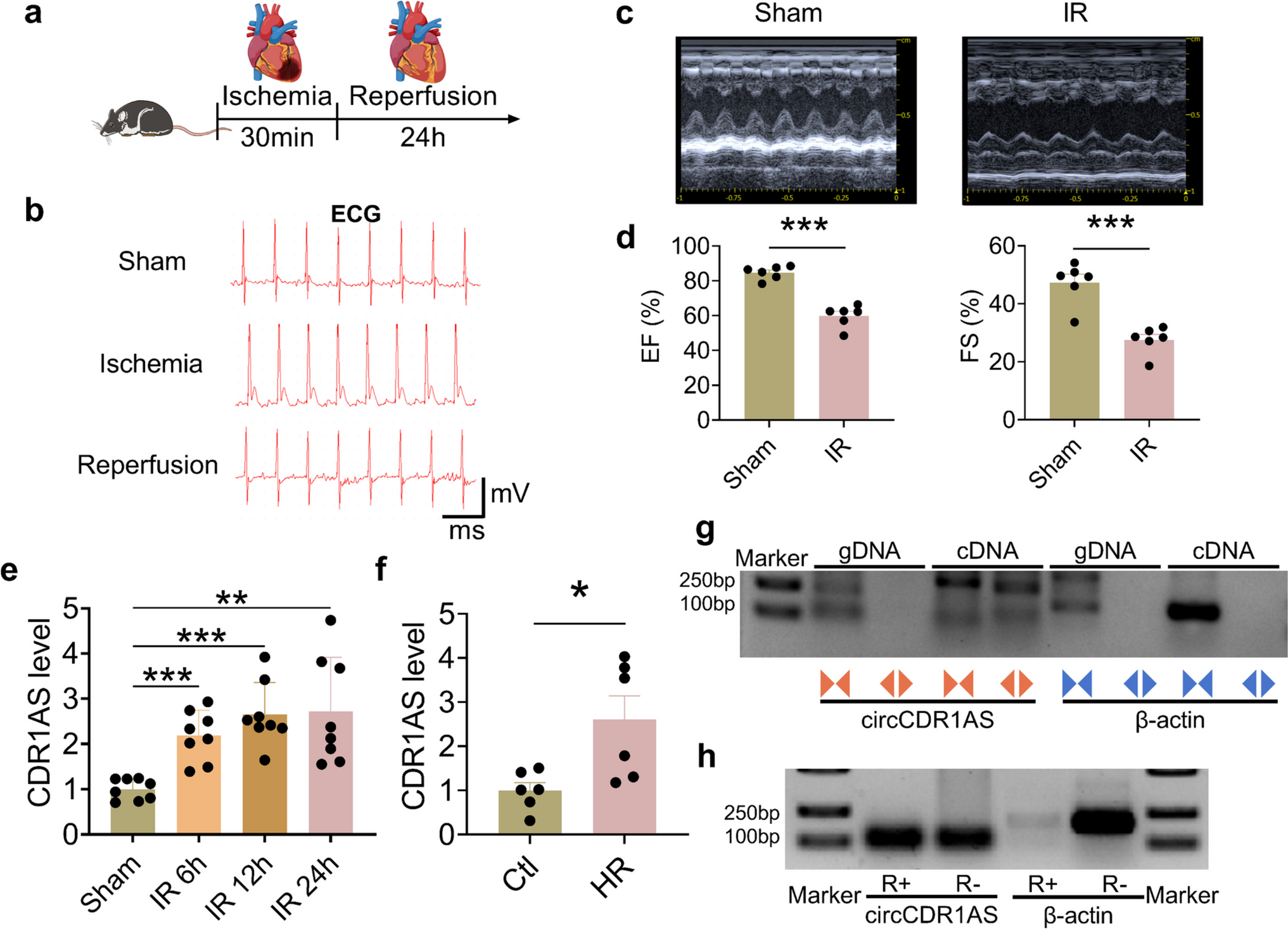 CircRNA CDR1AS promotes cardiac ischemia–reperfusion injury in mice by triggering cardiomyocyte autosis