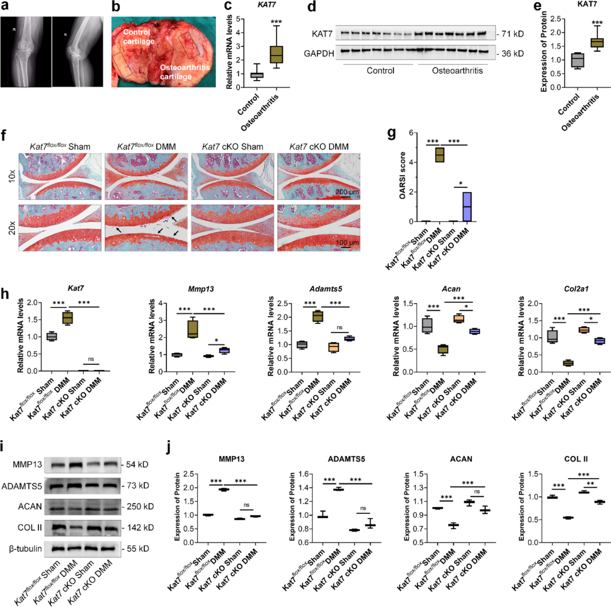 Kat7 accelerates osteoarthritis disease progression through the TLR4/NF-κB signaling pathway
