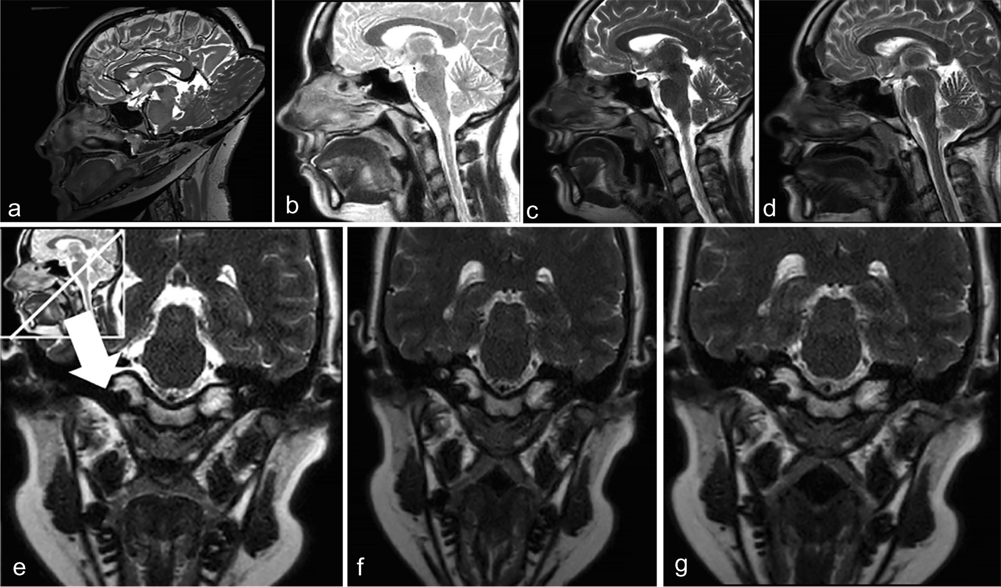 Development and evaluation of a training program for implementation of velopharyngeal MRI in the clinical setting