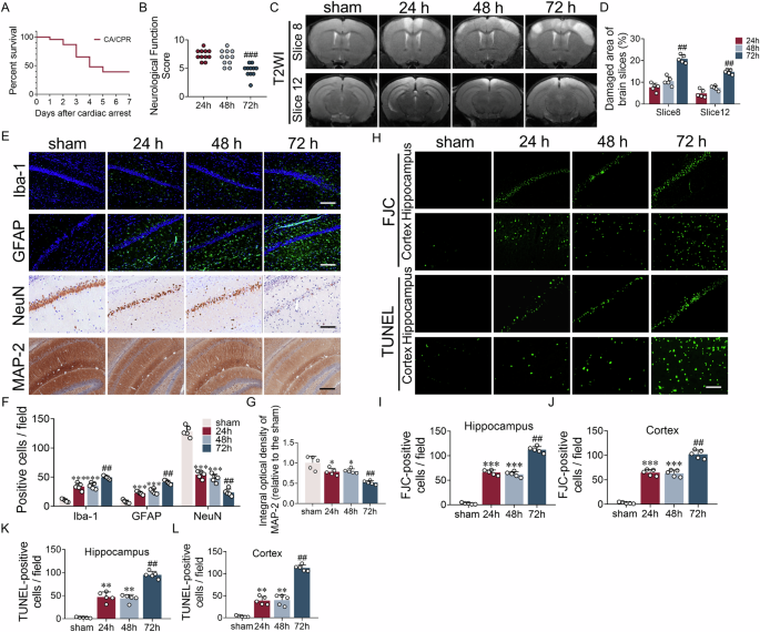 Gut-derived macrophages link intestinal damage to brain injury after cardiac arrest through TREM1 signaling
