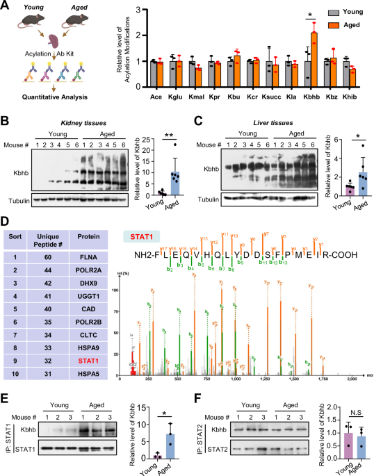 β-hydroxybutyrylation and O-GlcNAc modifications of STAT1 modulate antiviral defense in aging