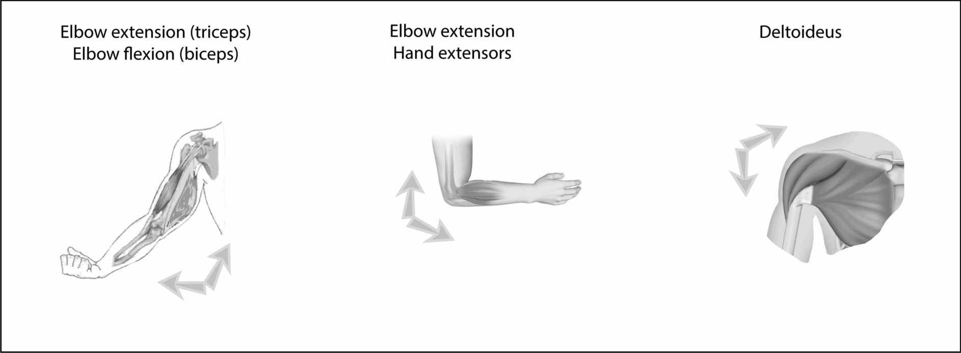 The deltoid muscle and the pattern of paresis in ALS