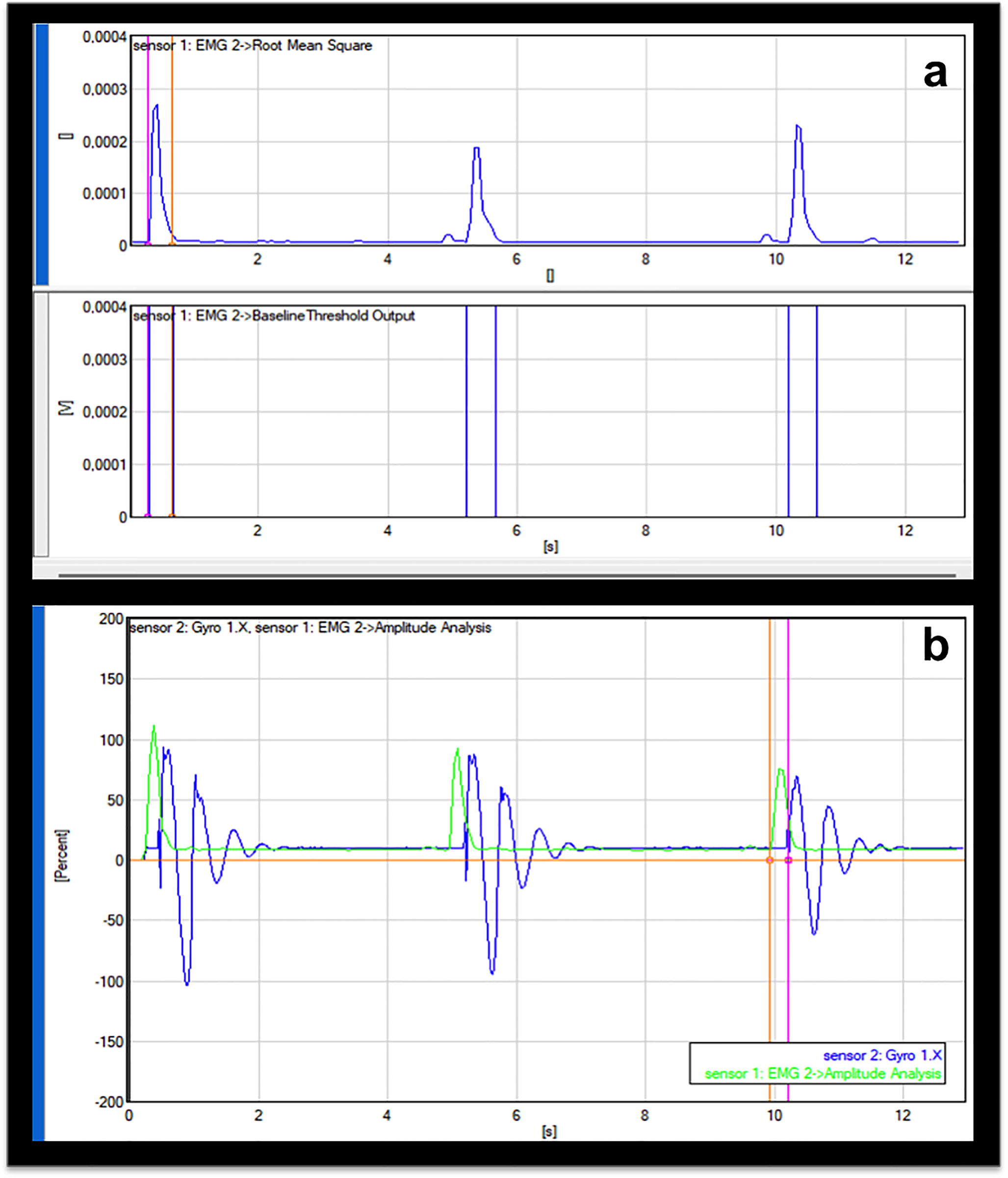 Diagnostic utility of deep tendon reflex responses in rectus femoris and triceps brachii in fibromyalgia: a clinical and electrophysiological study