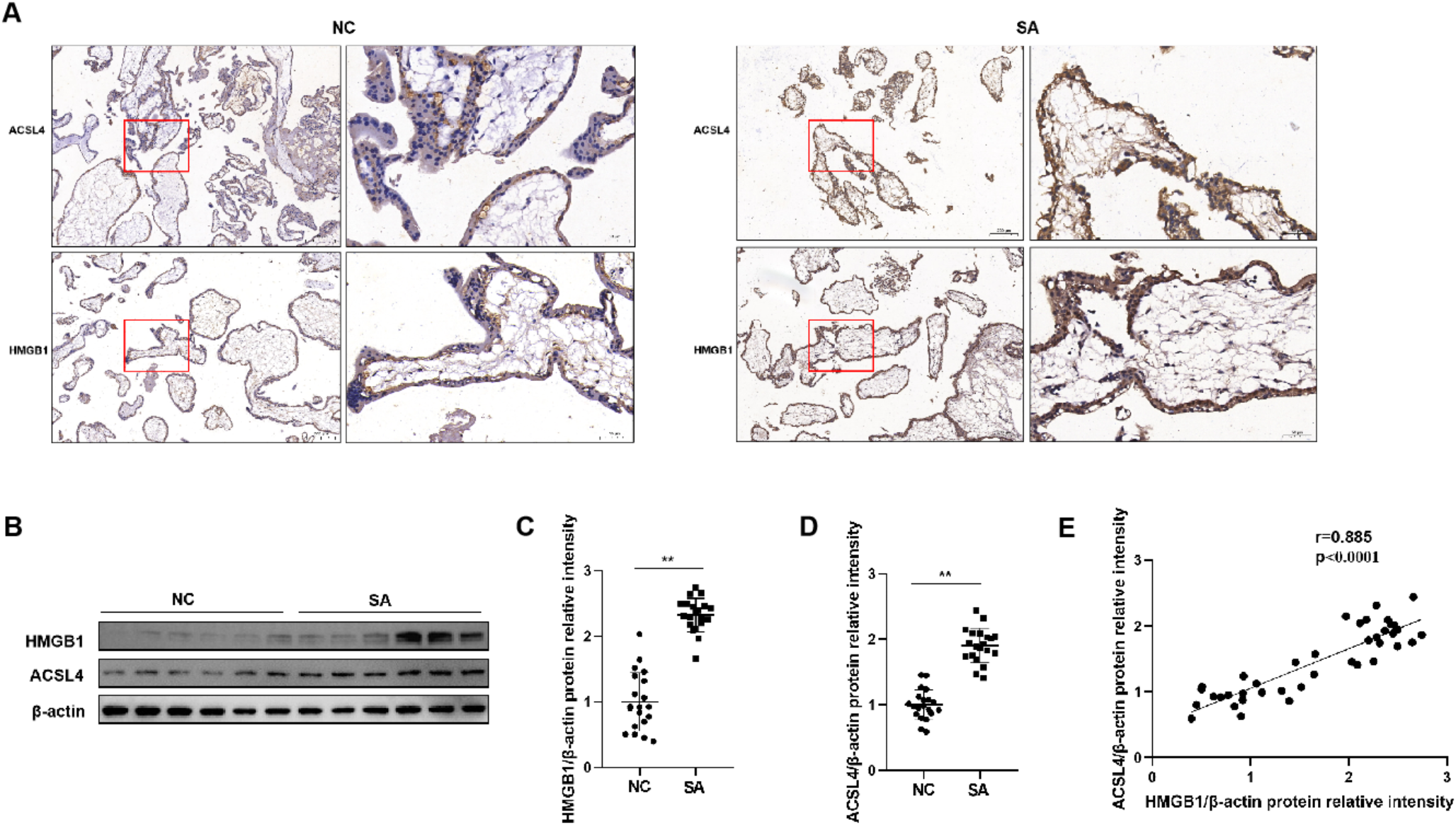 Increased Trophoblast Cell Ferroptosis via HMGB1/ACSL4 Pathway Is Associated with Spontaneous Abortion