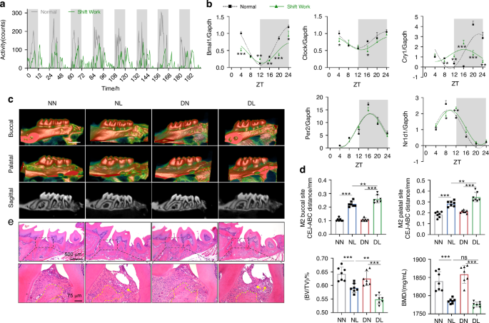 Circadian disruption by simulated shift work aggravates periodontitis via orchestrating BMAL1 and GSDMD-mediated pyroptosis