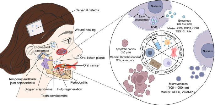 Emerging roles of extracellular vesicles in oral and maxillofacial areas