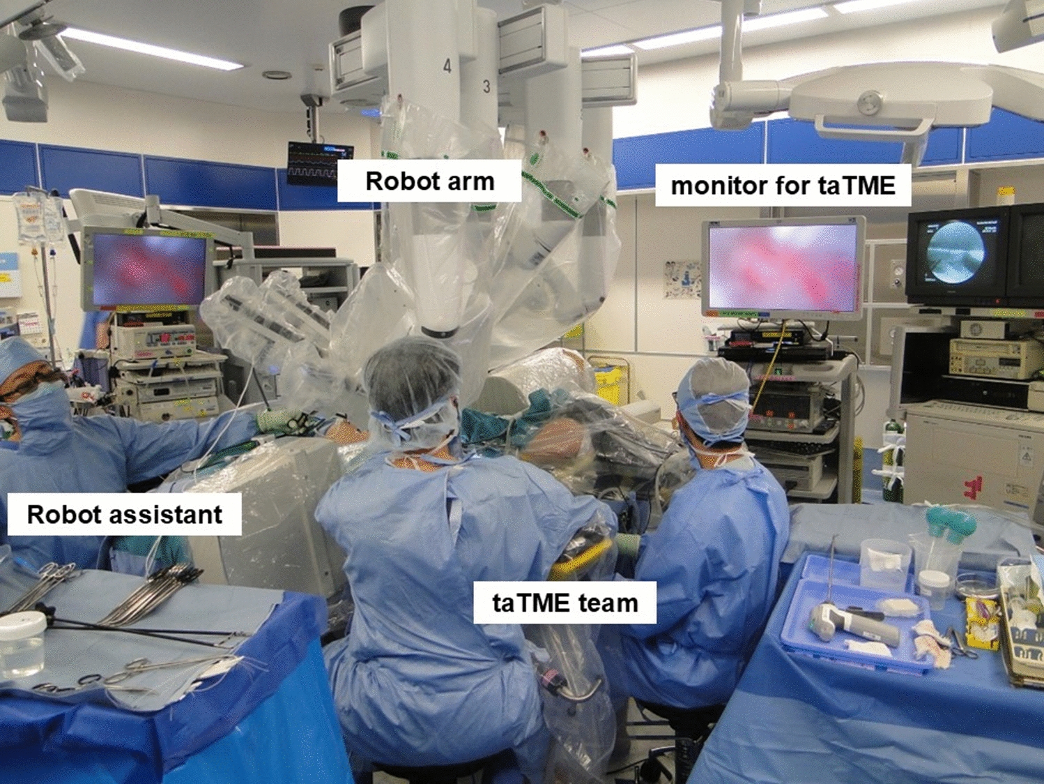 Feasibility of hybrid robotic rectal surgery