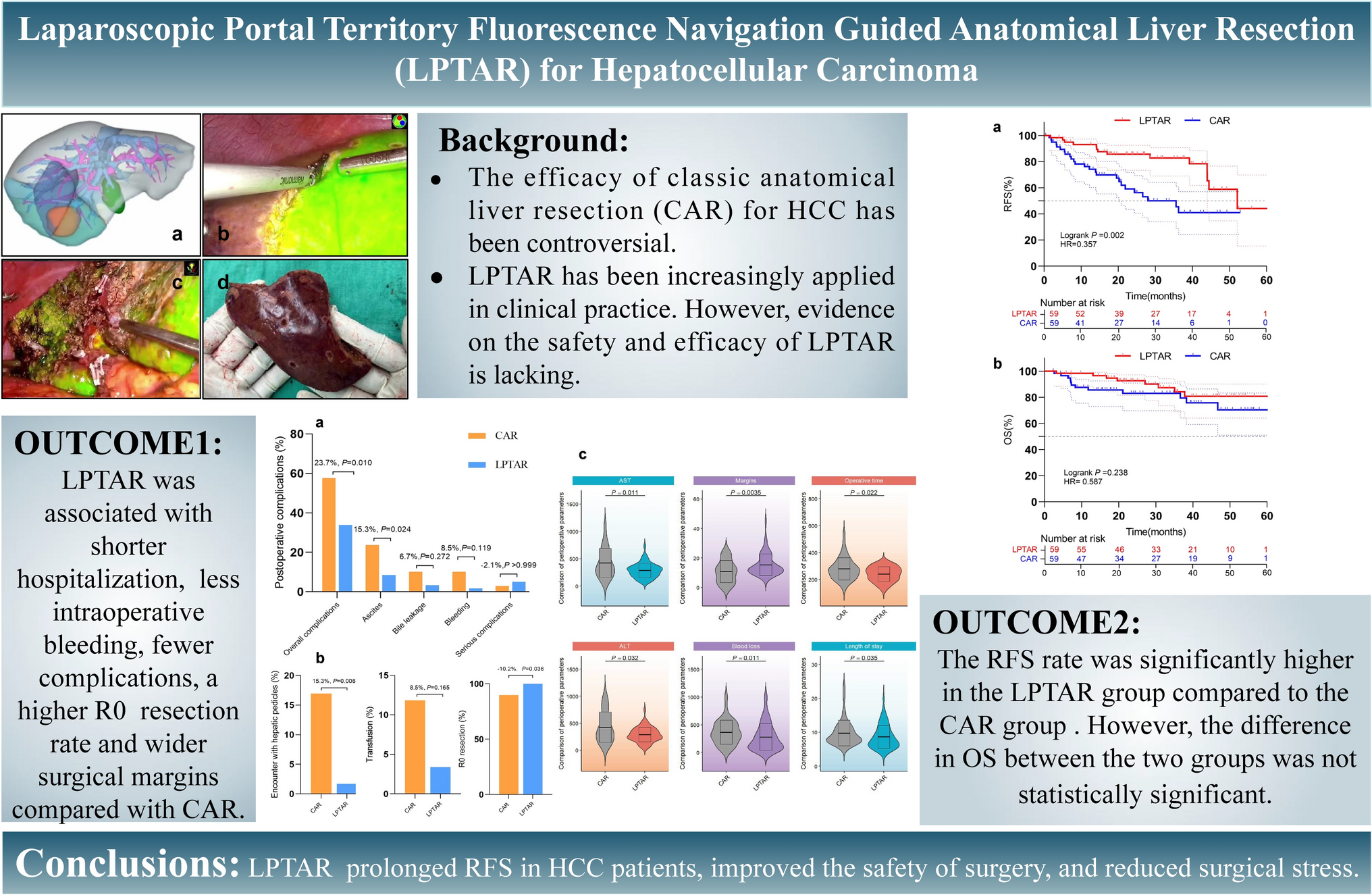 Safety and efficacy of laparoscopic portal territory fluorescence navigation-guided anatomical liver resection in hepatocellular carcinoma patients
