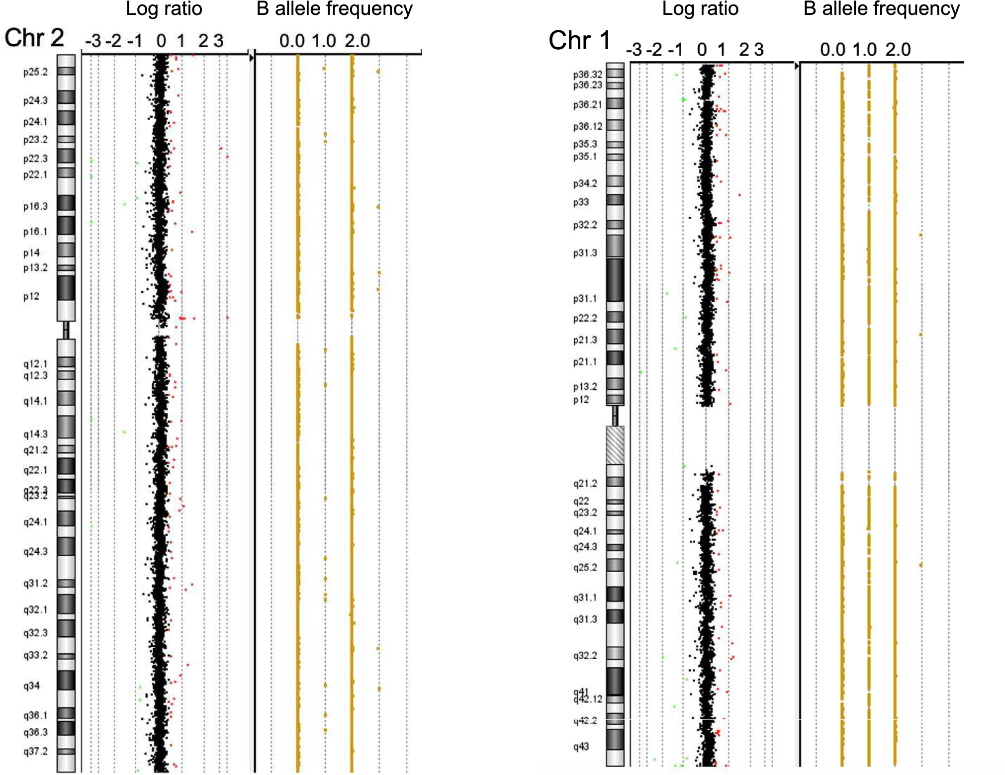 Case of maternal uniparental isodisomy with autosomal recessive Alport syndrome combined with congenital myasthenia and Oguchi disease