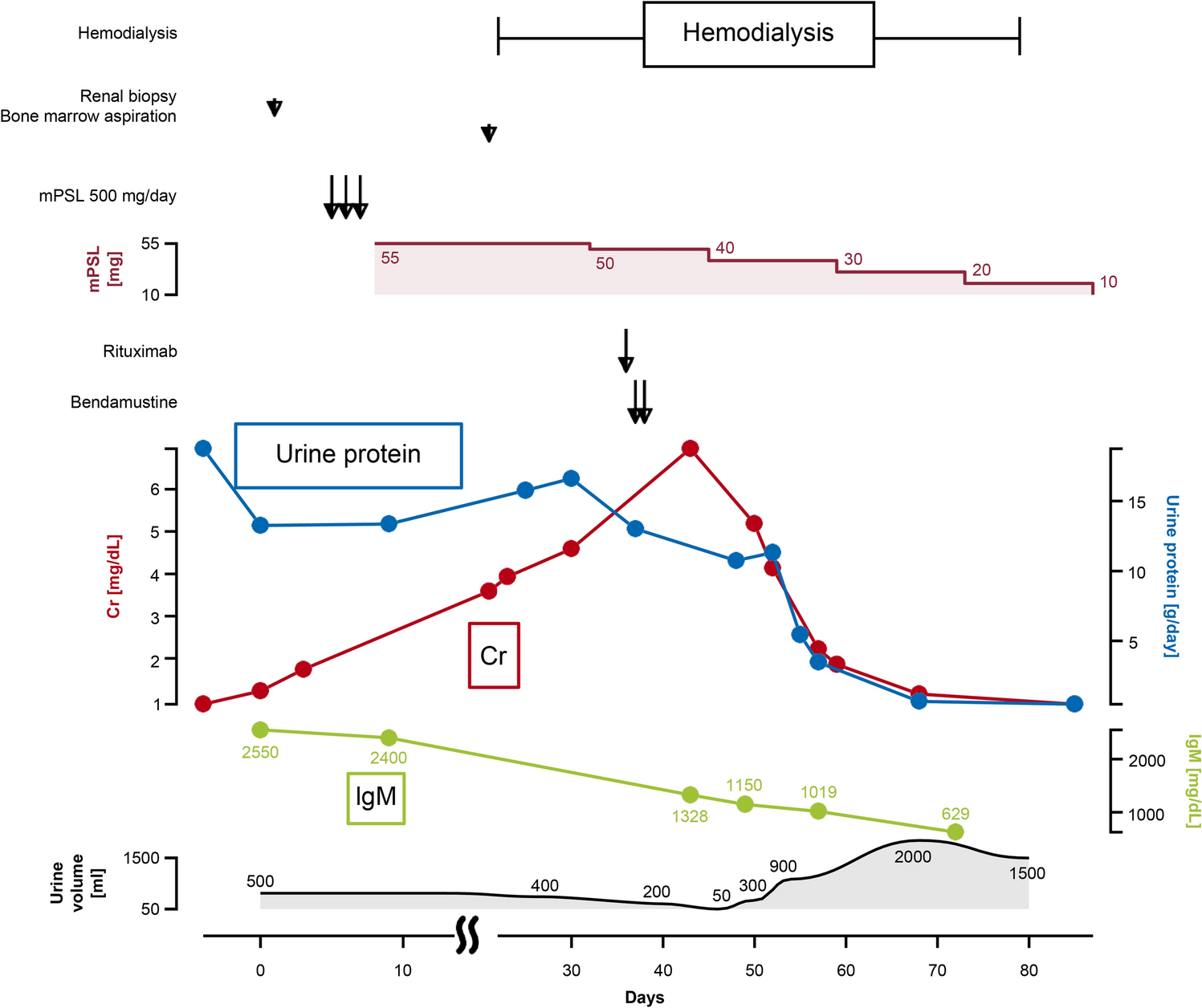 Steroid-resistant nephrotic syndrome as paraneoplastic syndrome of Waldenström macroglobulinemia: a case report