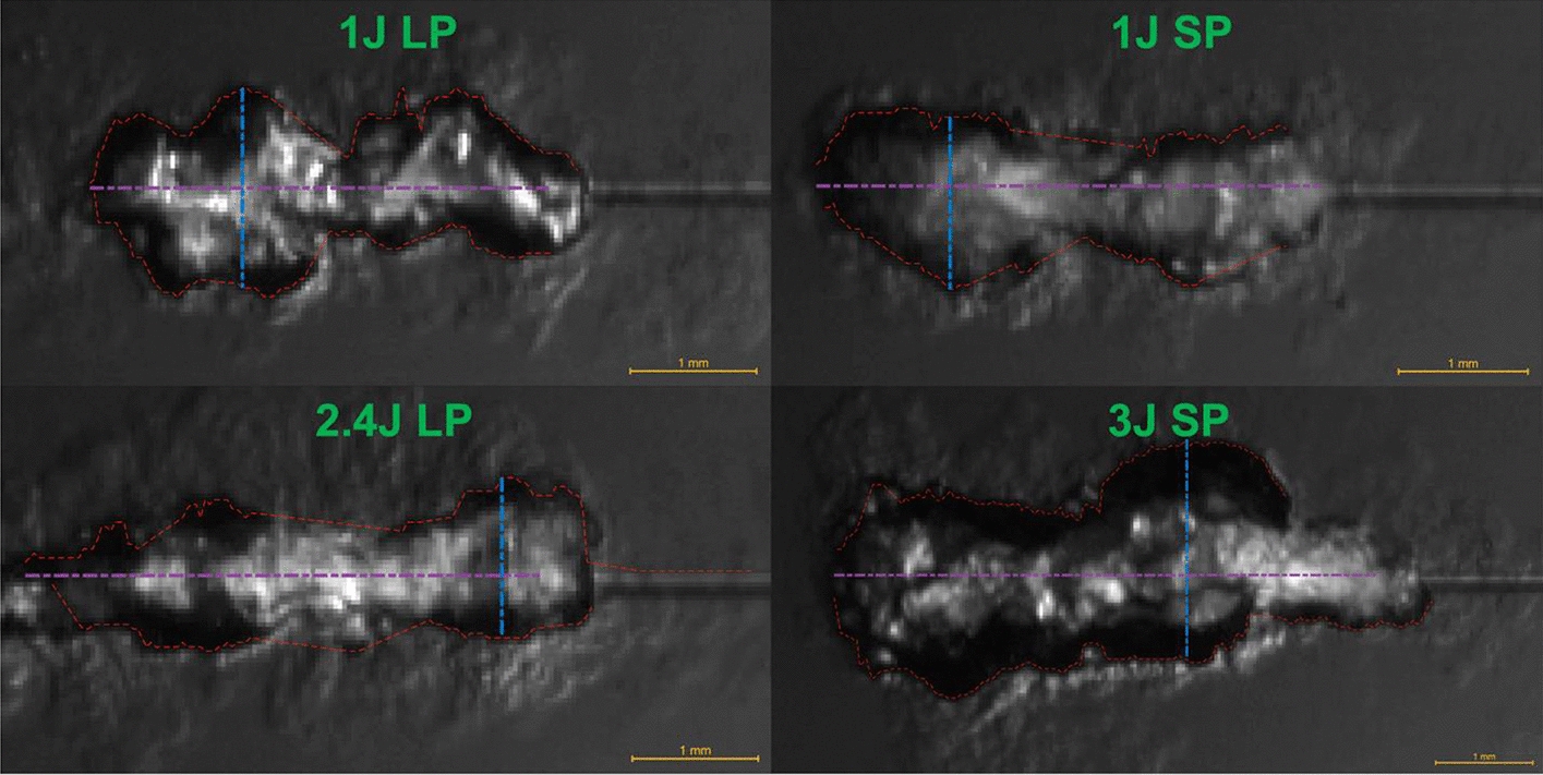 Characterizing stone ablation with the thulium fiber laser: a single-pulse comparison of different pulse durations