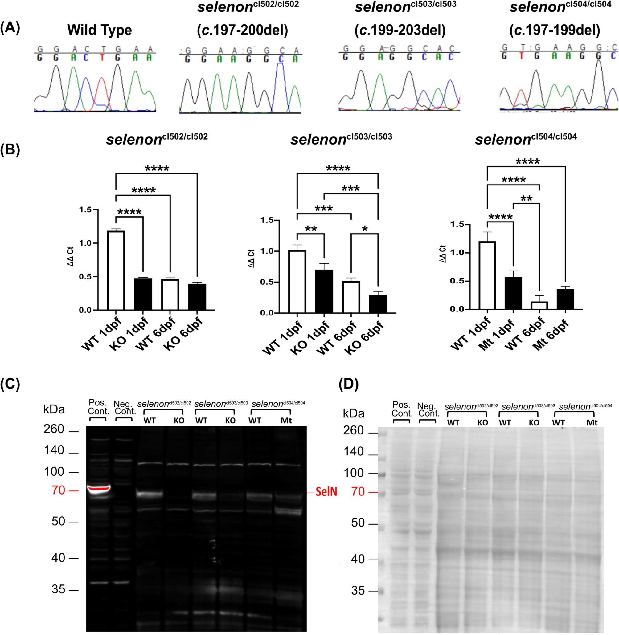 Zebrafish and cellular models of SELENON-Congenital myopathy exhibit novel embryonic and metabolic phenotypes