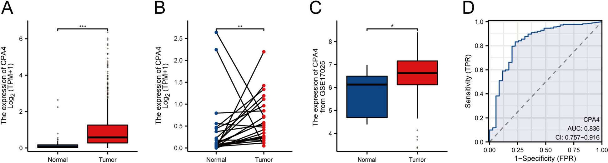 CPA4 overexpression correlates with poor prognosis and tumor progression in endometrial cancer