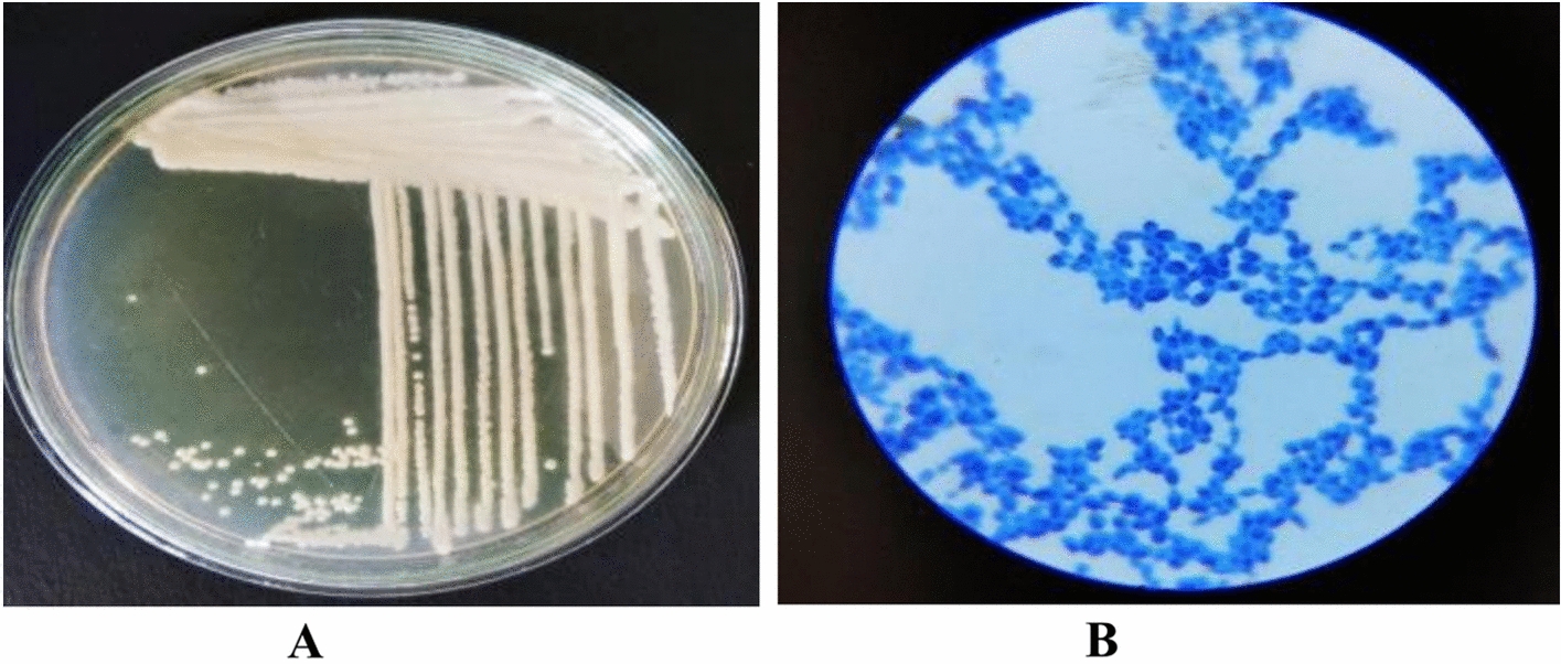 Validation of pre-treatments for cost effective production of bioethanol from floral wastes