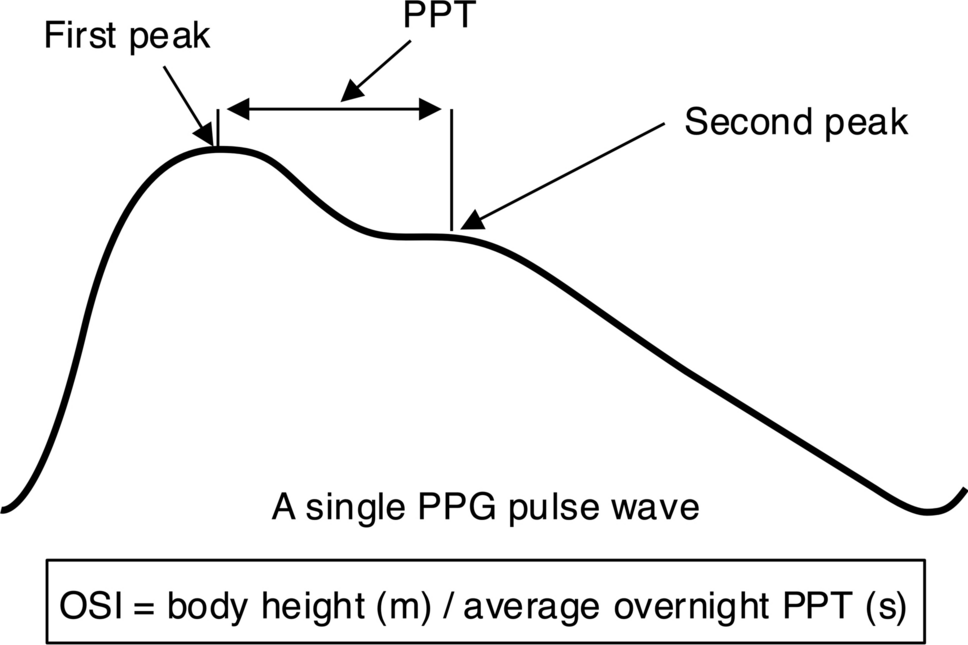 Overnight stiffness index from finger photoplethysmography in relation to markers of cardiovascular risk and vascular ageing